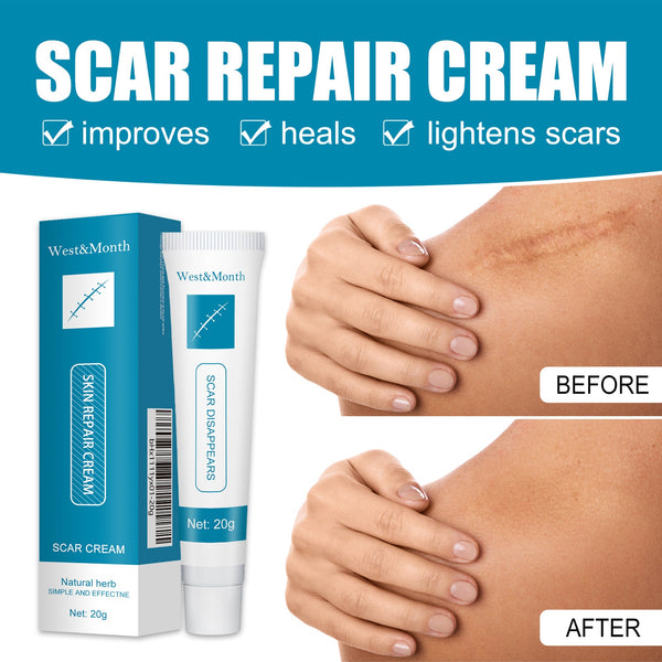Skin Repair Cream Gentle Moisturizing Hydrating Moisturizing Repair Skin Care Repair Cream