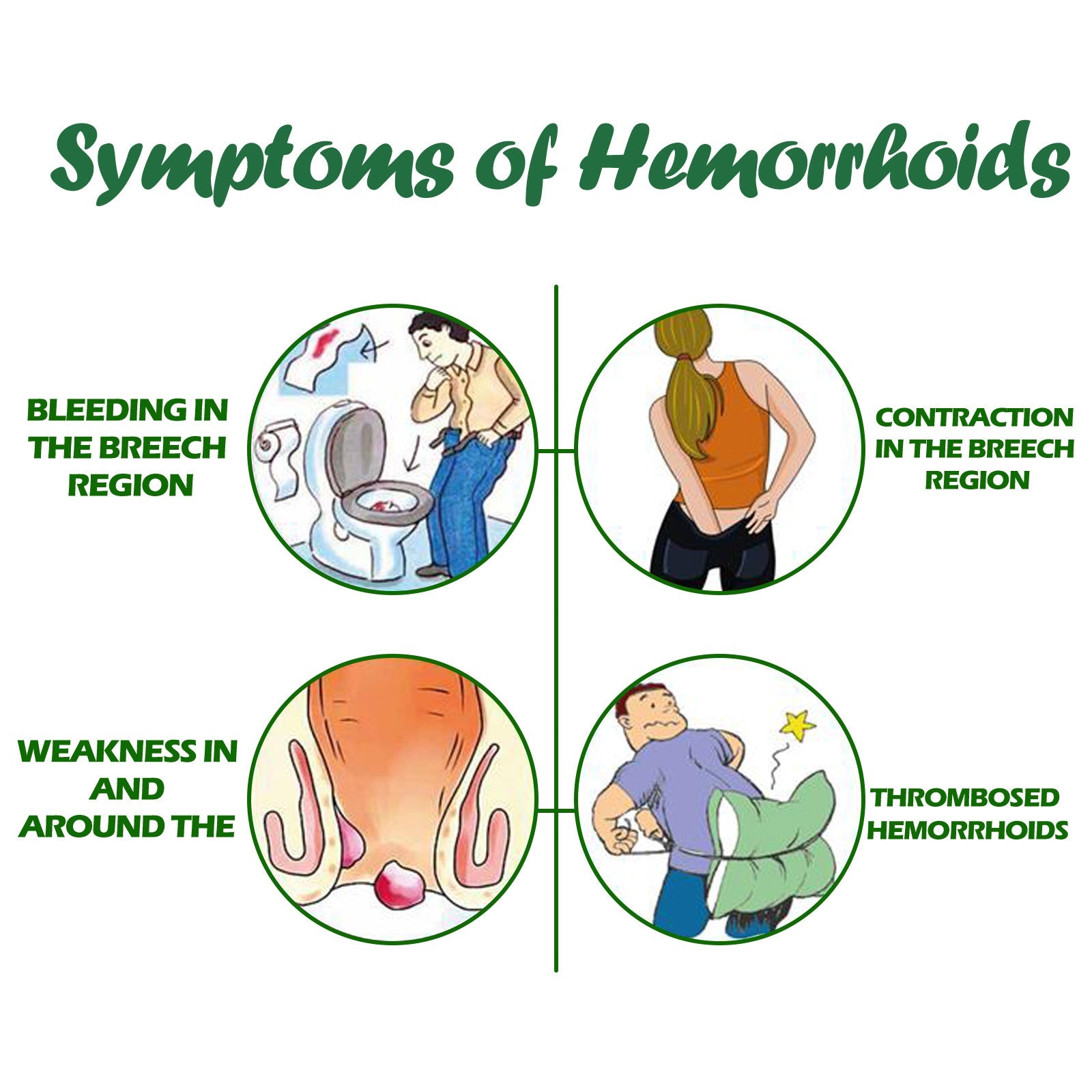 Hemorrhoids Spray, Relieve Swelling And Hemorrhoid Pain External Treatment For Broken Sore Anal Soothing Spray