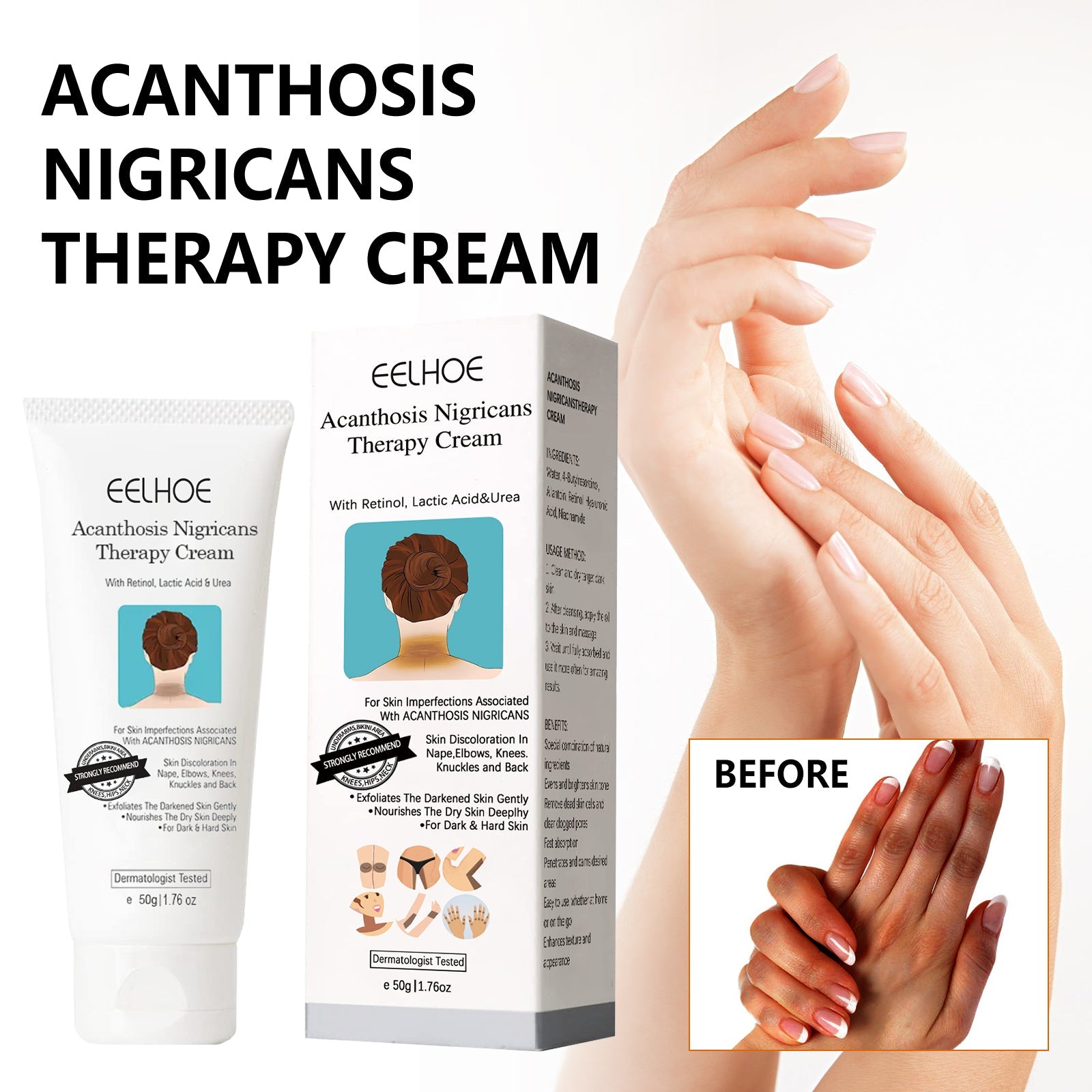 Black Acanthoderm Repair Cream Repair Underarm Arm Knee Joint Black Moisturizing Whitening Body Care Cream