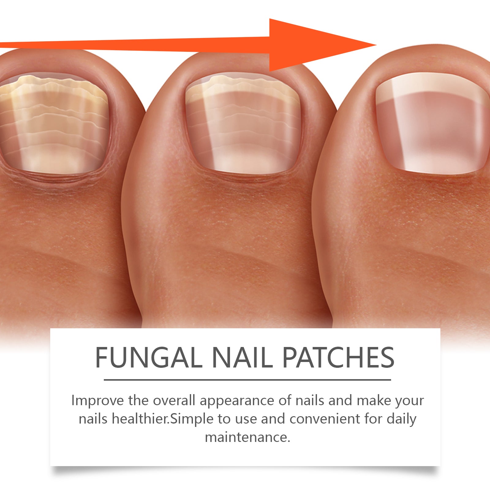 Nail Care Patches Gently Repair Nails For Easy Daily Cleaning With Simple Care Patches