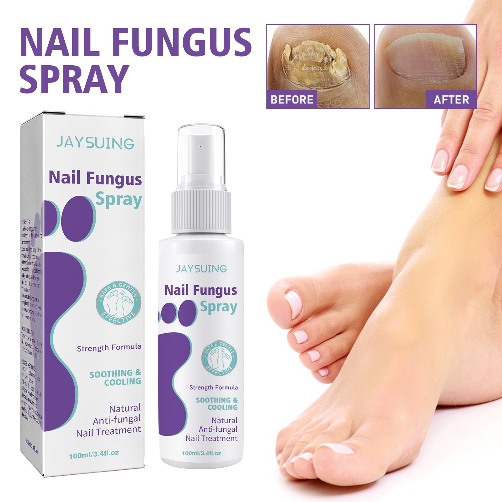 Gray Nail Care Spray Soft Ingrown Nails, Ingrown Nails, Yellowing And Thickening Cleaning Care