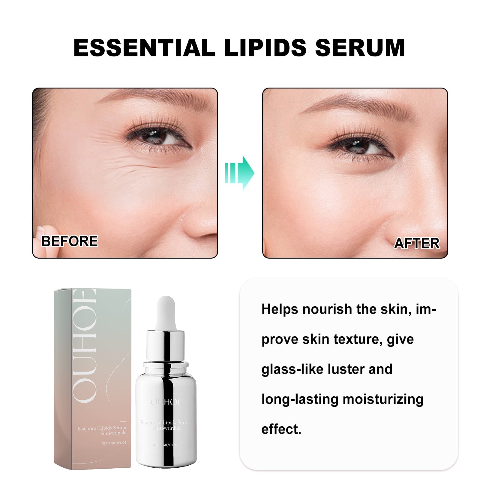 Essentical Lipids Serum, The Face Tightens The Fine Lines Of The Eyes Of The Law Wrinkles The Skin Anti-Wrinkle And Anti-Aging