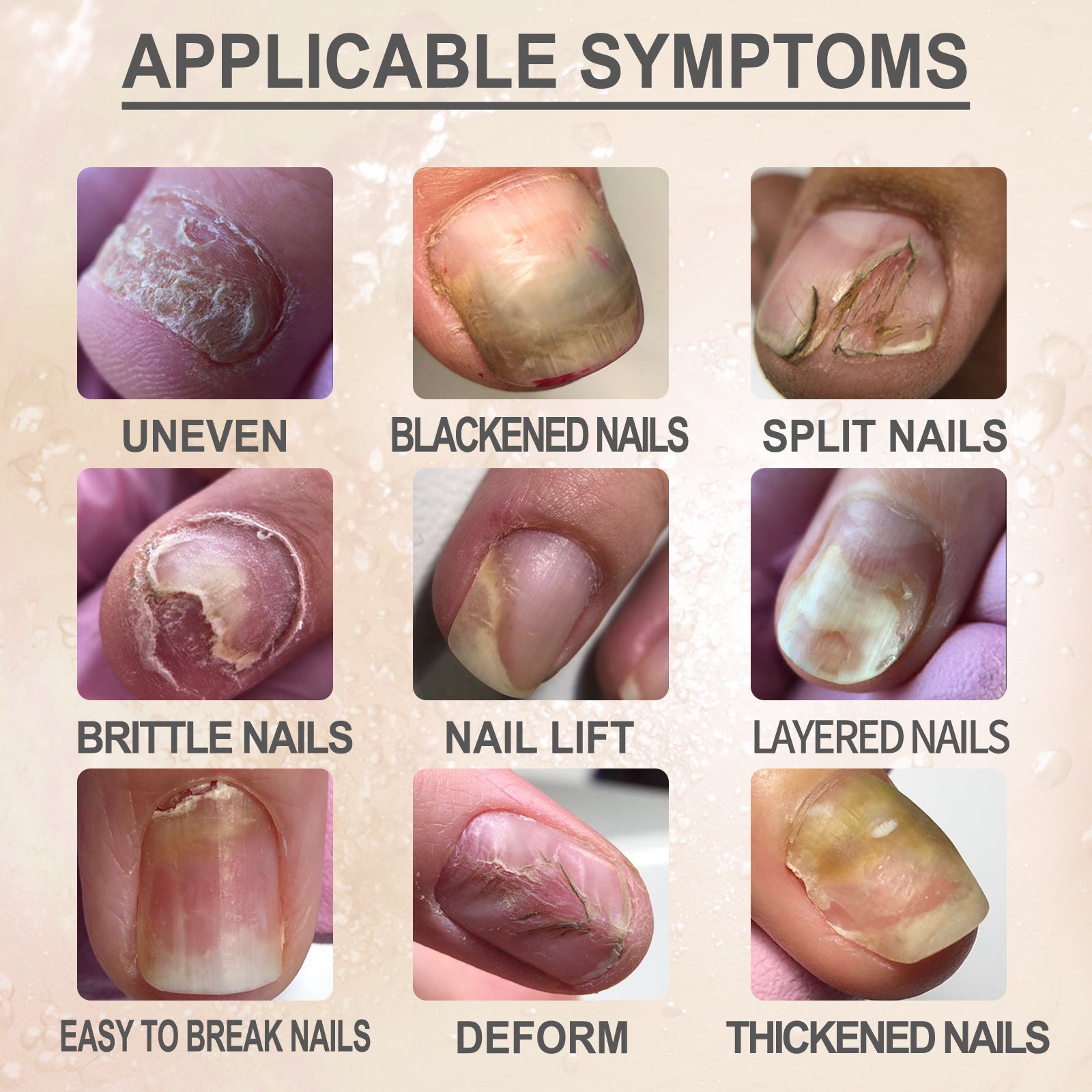 7 Day Nail Repair Essence, Hand And Foot Gray Nail Brightening Soft Nail Thickening Toenail Care Solution