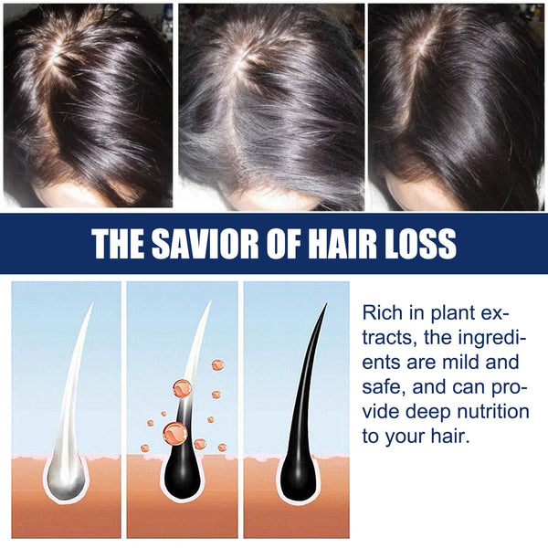 Alopecias Hair Growth Cream, Protect Hair Follicles Strong Moisturizing Thick Hairline Hair