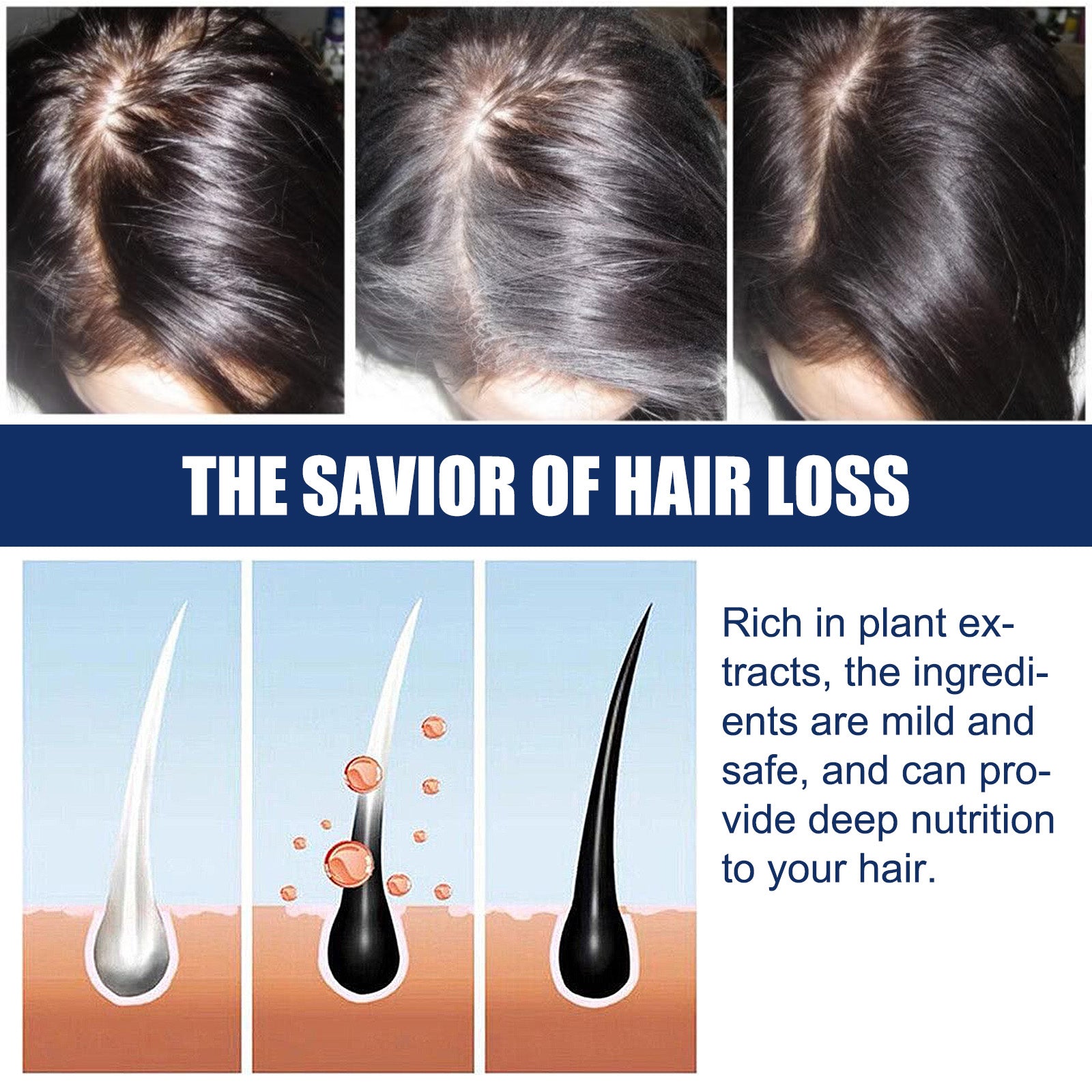 Alopecias Hair Growth Cream, Protect Hair Follicles Strong Moisturizing Thick Hairline Hair