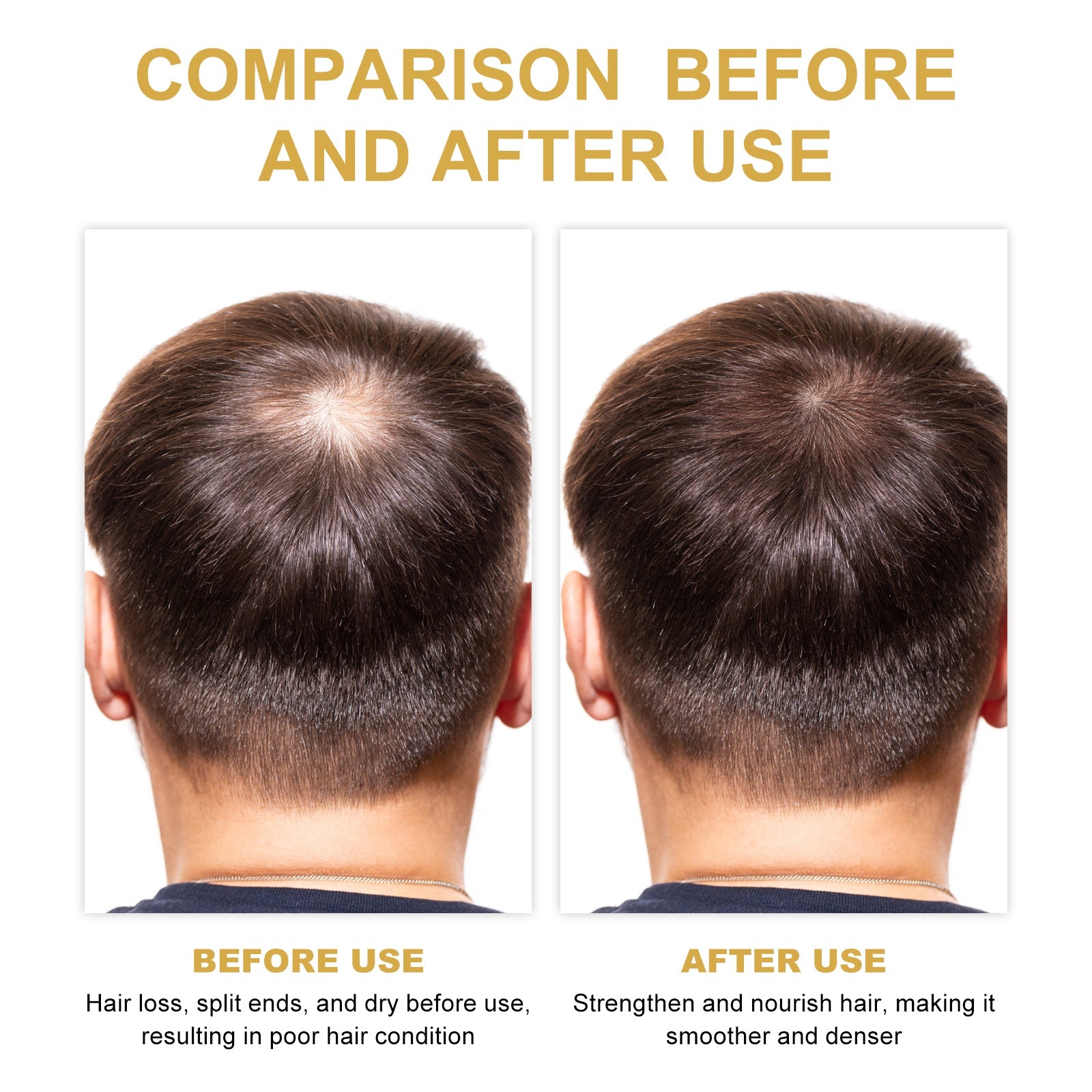 Hair Dense Oil, Scalp Cleaning Care Fluffy Soft Repair Dry Hair Impetuous Solid Hair Dense Hair Essential Oil