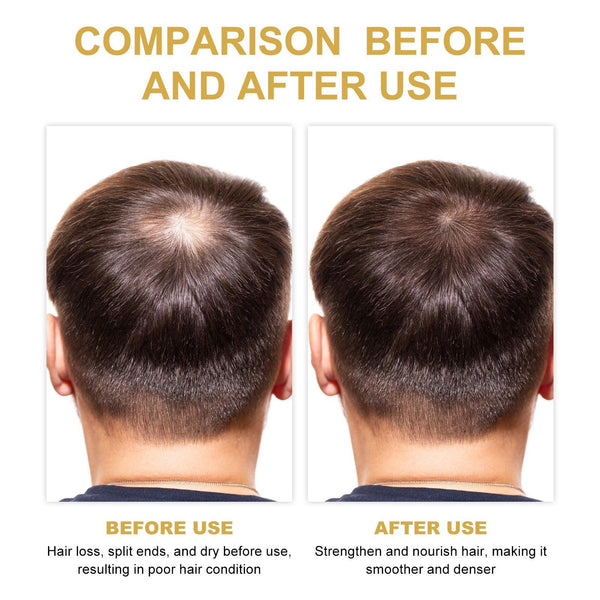 Hair Dense Oil, Scalp Cleaning Care Fluffy Soft Repair Dry Hair Impetuous Solid Hair Dense Hair Essential Oil