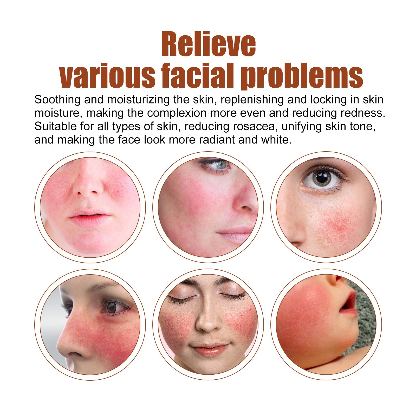 Erythematous Repair Essence, Repair Skin Lighten Facial Erythematous Moisturizing Essential Oil