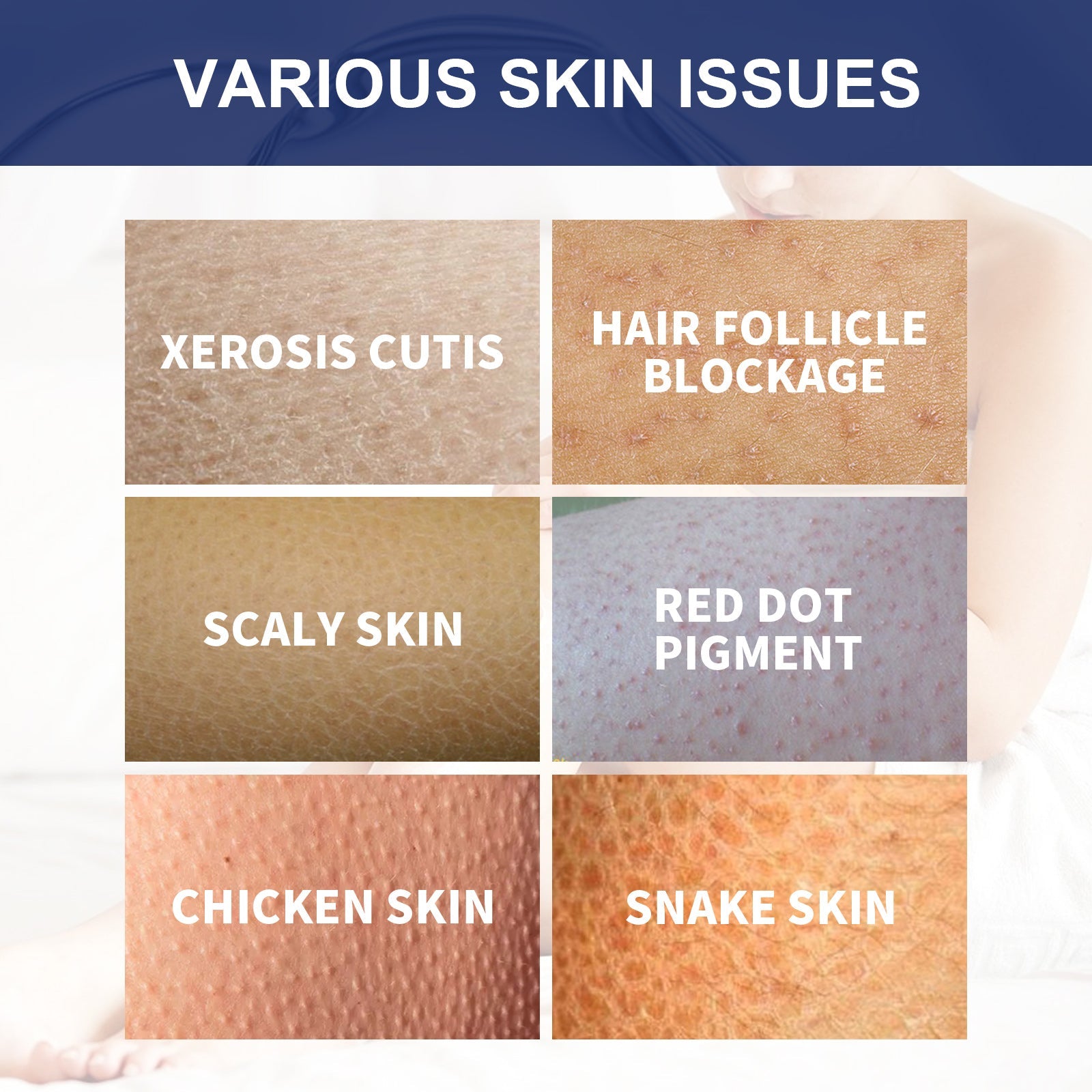 Body Whitening Scrub, Deep Body Cleansing Treatment Gently Exfoliates Dead Skin Whitening Skin