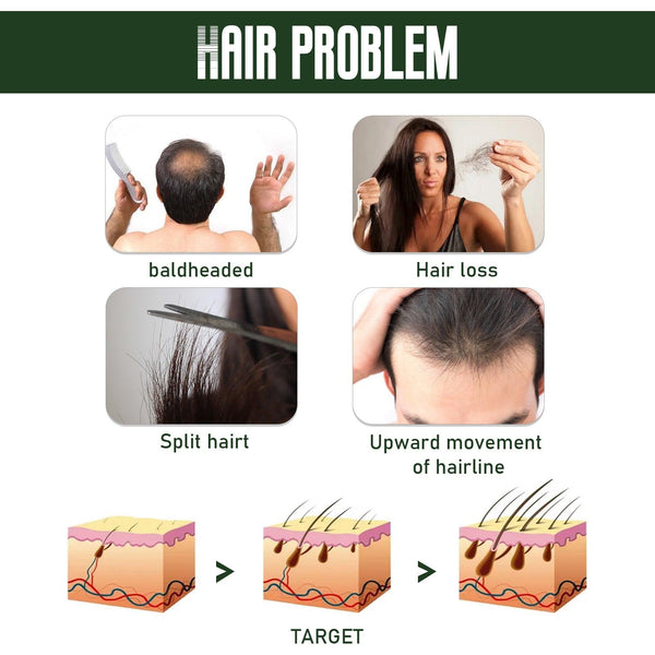 Ginger Dense Hair Spray Nourishes Hair Follicles, Prevents Hair Loss And Breaks, Moisturizes And Thickens Hair Spray
