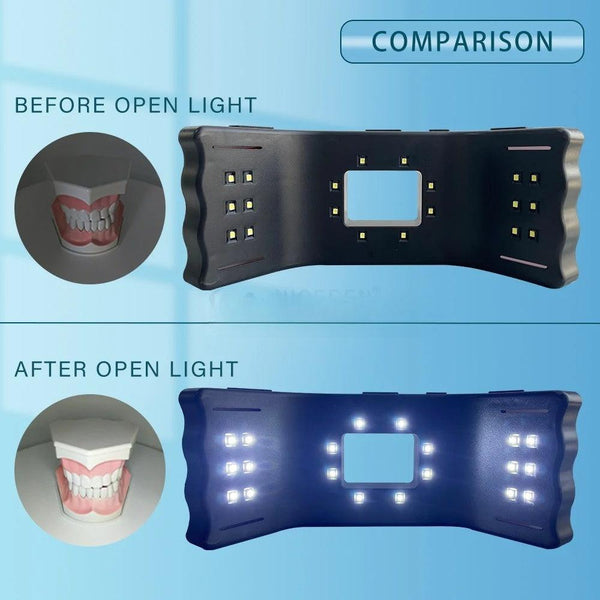 Dental oral fill light LED orthodontic dental fill light mobile phone universal handheld dental photography tool