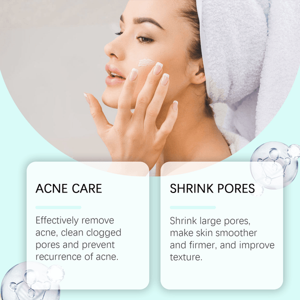 Azelaic Acid Acne Cream, Oil Control Gentle Moisturizing Acne Skin Moisturizing Daily Facial Cream