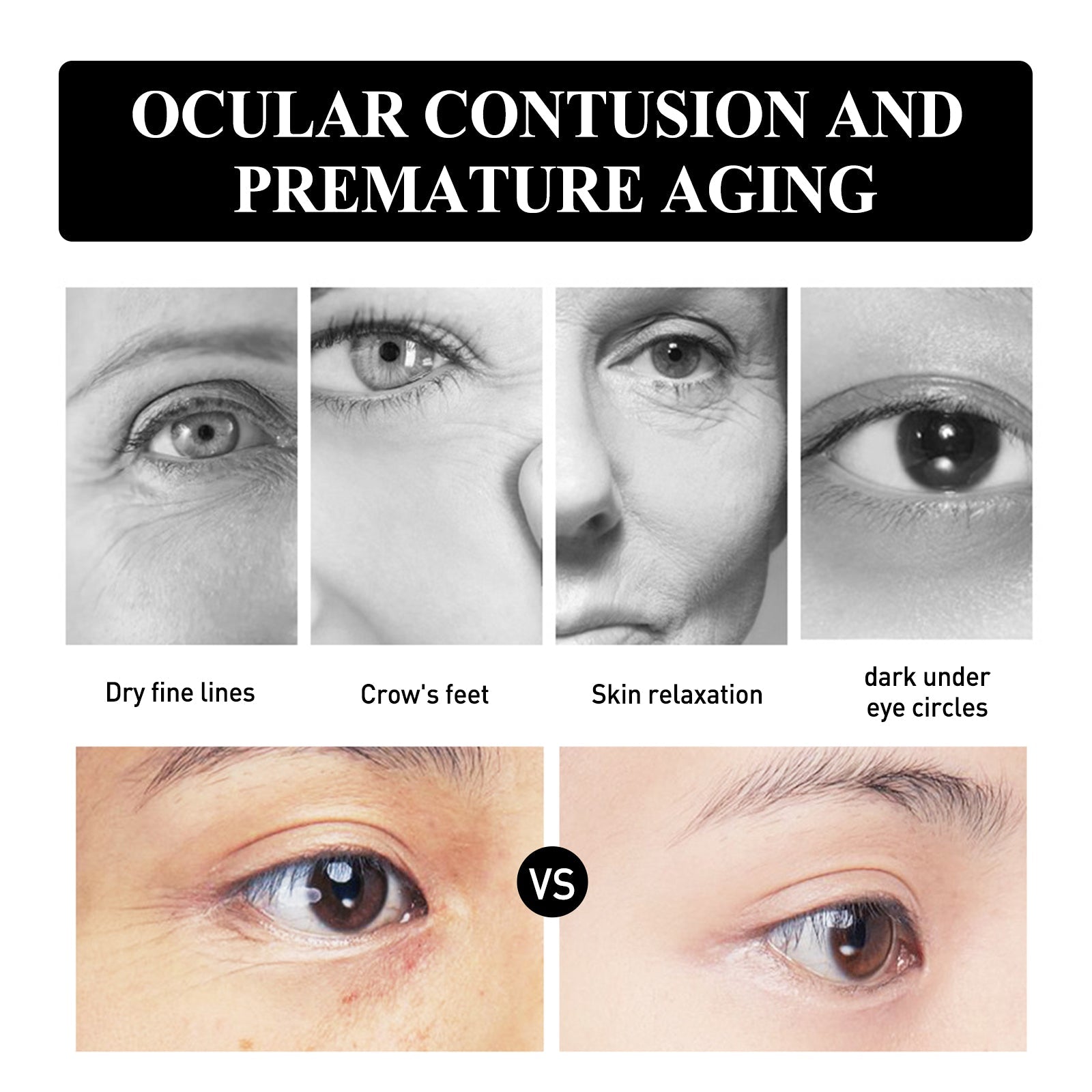 Snake Venom Peptide Moisturizing Eye Cream, Reduce Fine Line Eye Bags Hydrating, Anti-Aging And Anti-Wrinkle Eye Cream