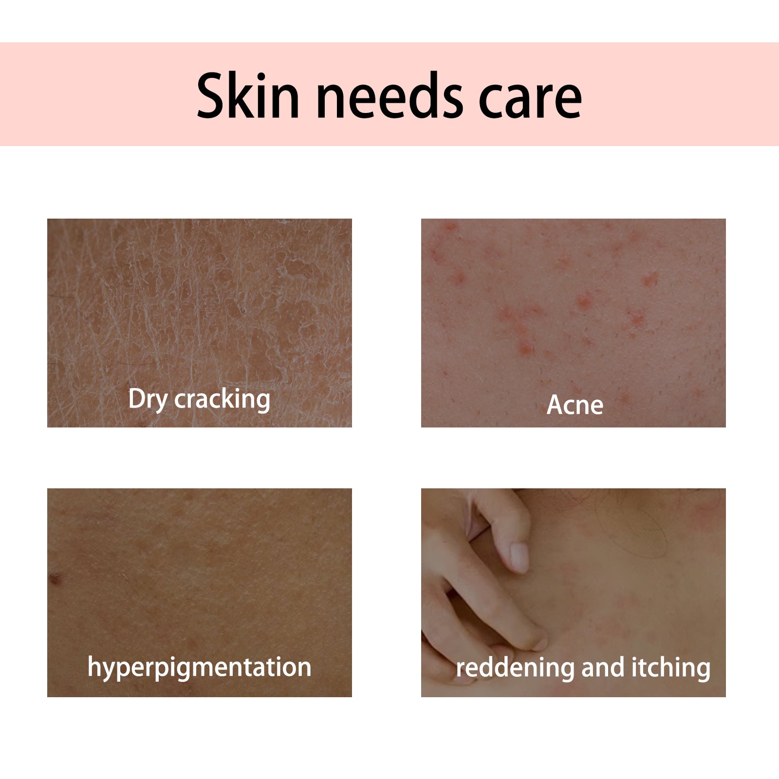 Handcrafted Body Oil, Hydrating And Moisturizing Essential Oil For Firming And Soothing Skin