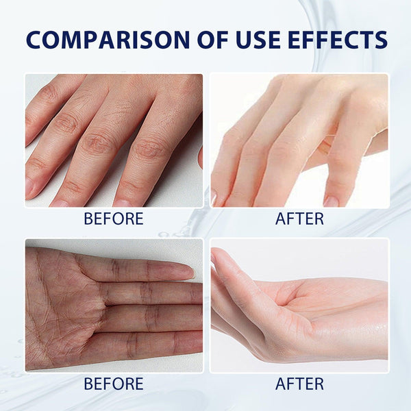 Aloe Vera Care Gel, Hydrating And Refreshing Moisturizing Cream Prevents Dryness And Cracks To Repair Hand Skin