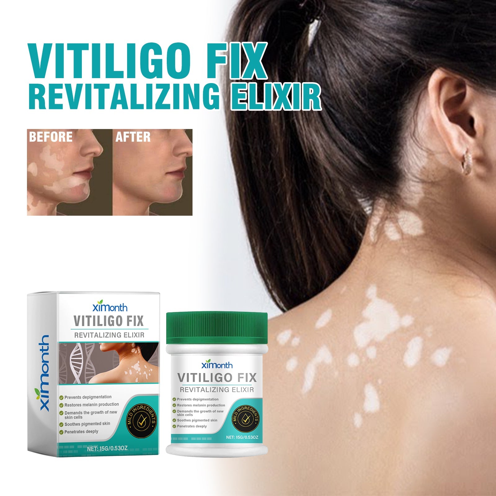 Vitiligo Fix Revitalizing Elixir, Lighten Skin Spots Even Skin Tone Moisturizing Body Care Repair Cream