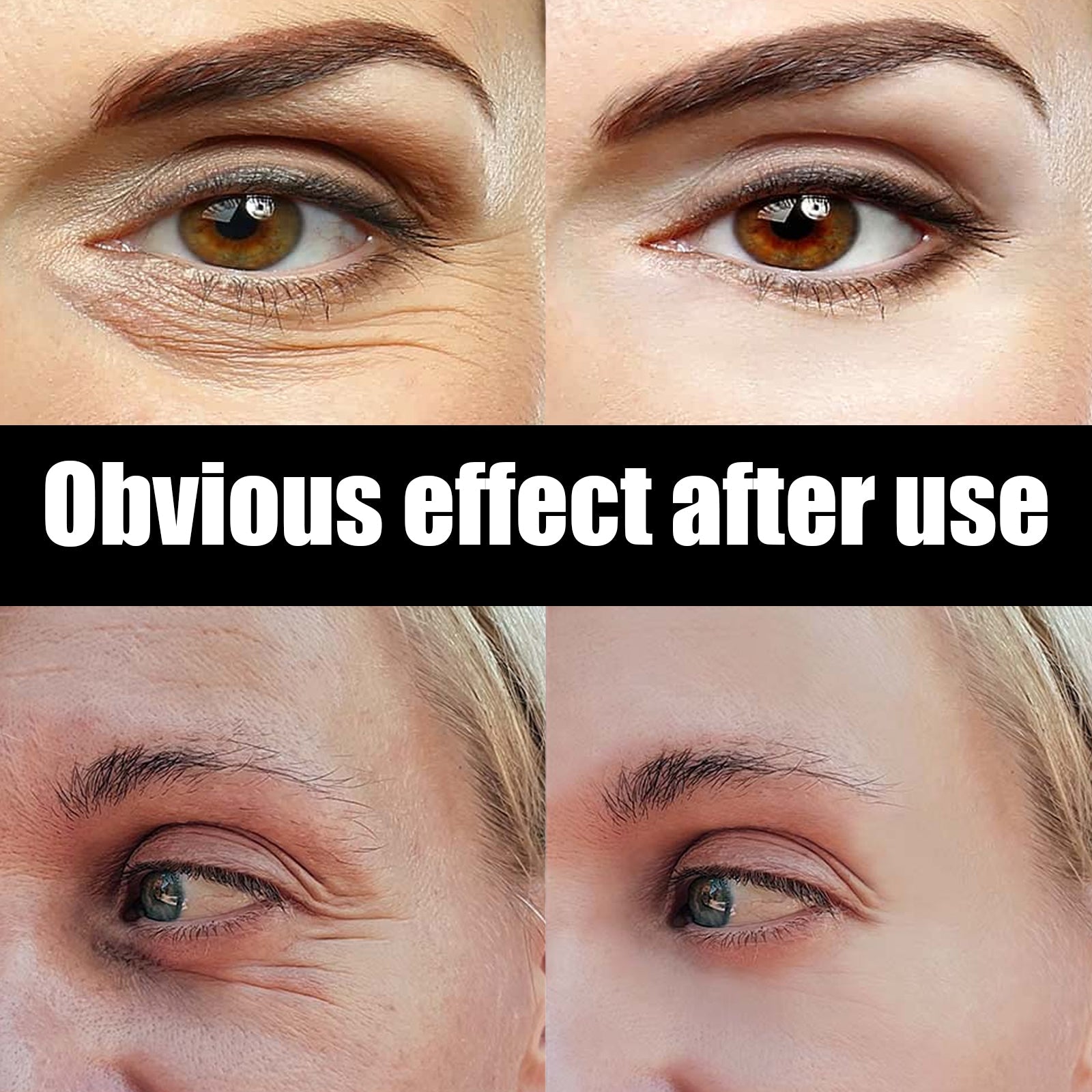 Astaxanthin Caviar Eye Cream, Moisturizing Skin Care Firming Fade Lines Eye Cream