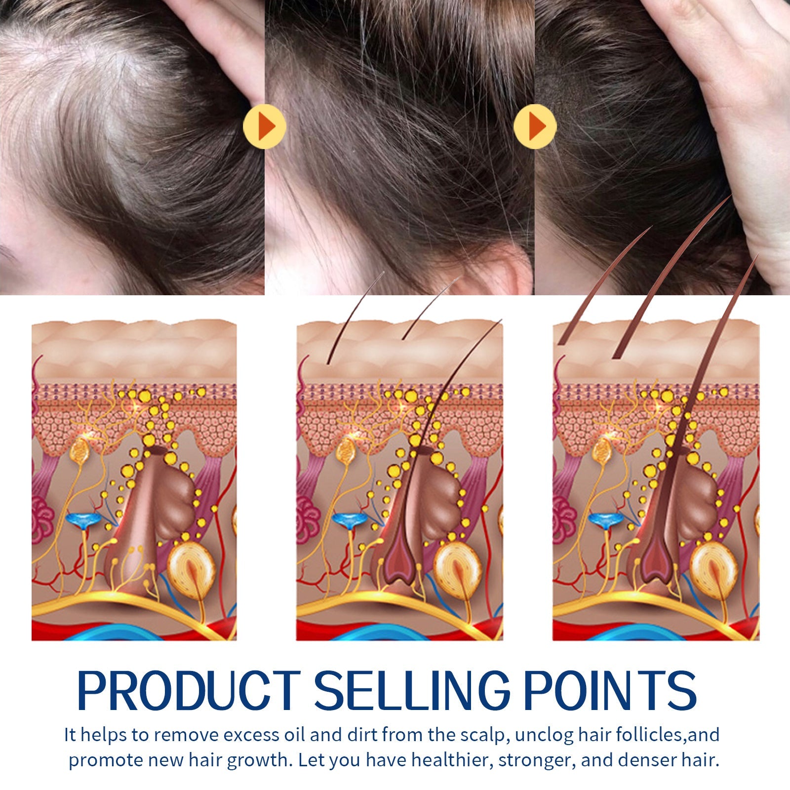 Hair Scrub Cleans Scalp Dandruff, Soothes Itchiness, Moisturizes Dense, Firming, And Prevents Hair Loss