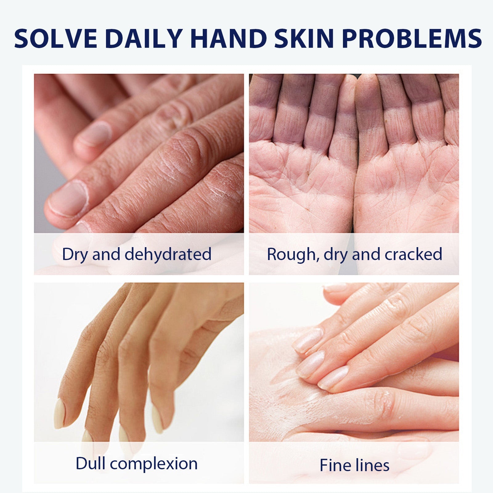 Aloe Vera Care Gel, Hydrating And Refreshing Moisturizing Cream Prevents Dryness And Cracks To Repair Hand Skin