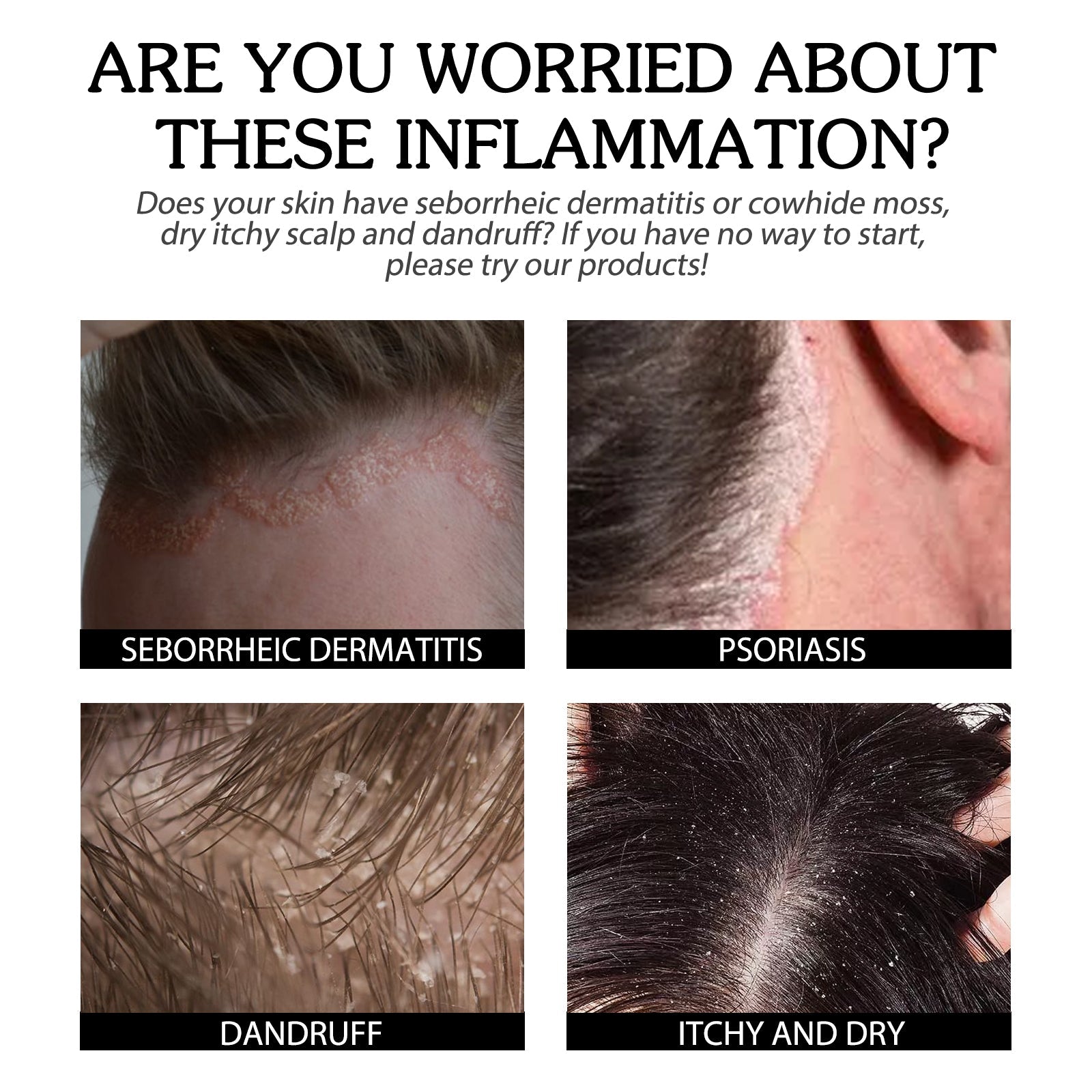 Cowhide Moss Repair Spray Relieves Redness And Itchy Scalp Skin Repair Spray