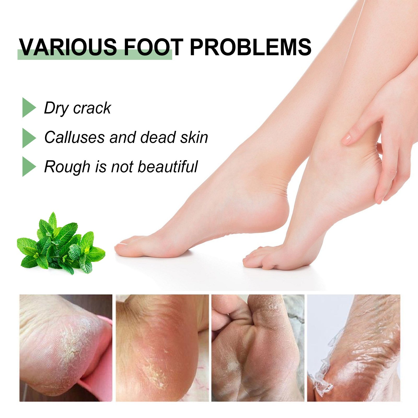 Peppermint Foot Cream, Repair The Foot Prevent Weather-Shack Desquamate Cracked Heels Moisturize Foot Care Cream