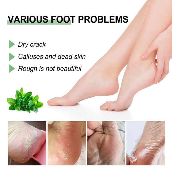 Peppermint Foot Cream, Repair The Foot Prevent Weather-Shack Desquamate Cracked Heels Moisturize Foot Care Cream