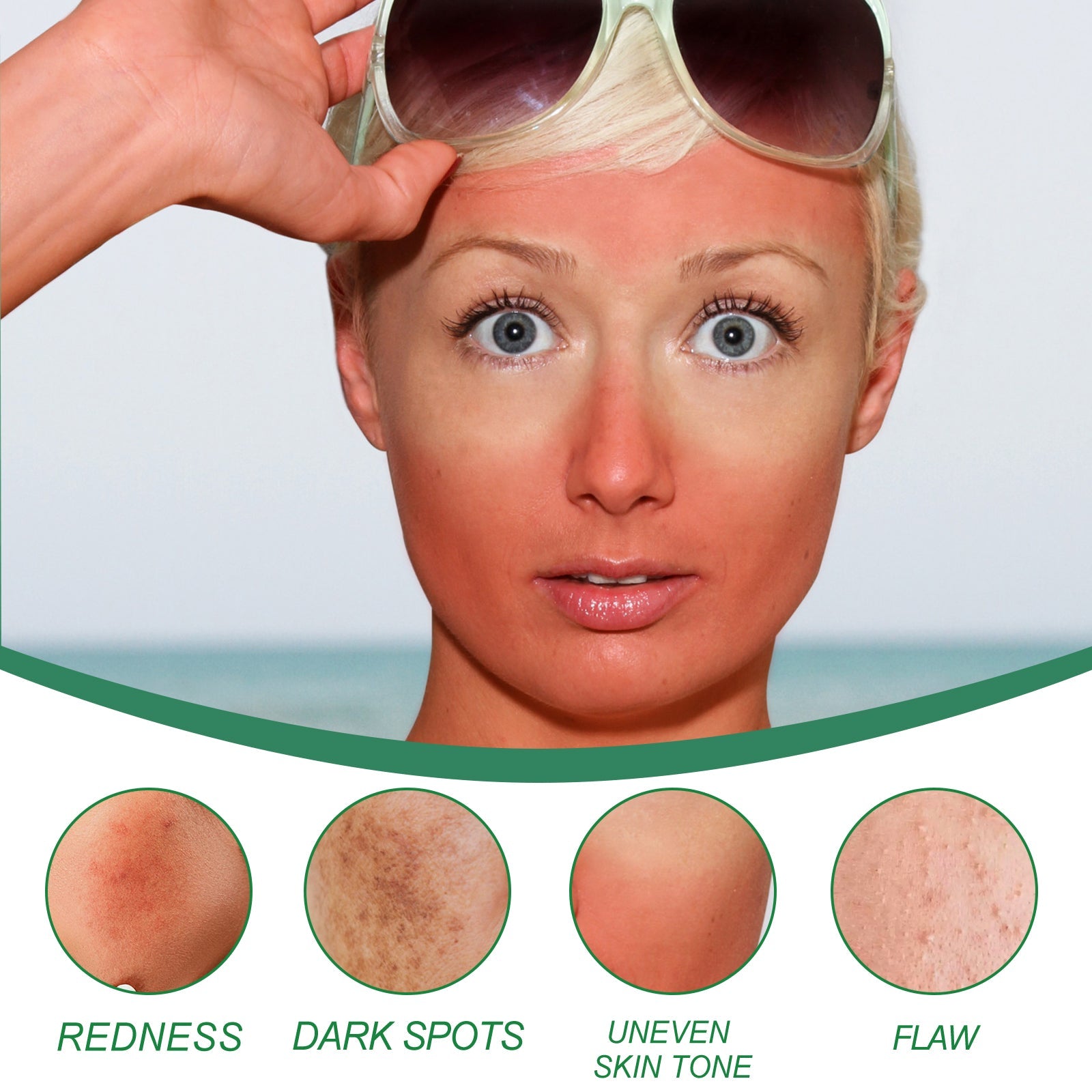 Color Correction Treatment Cream, Lighten Spots After Sun Repair Moisturizing Skin Beauty Cream