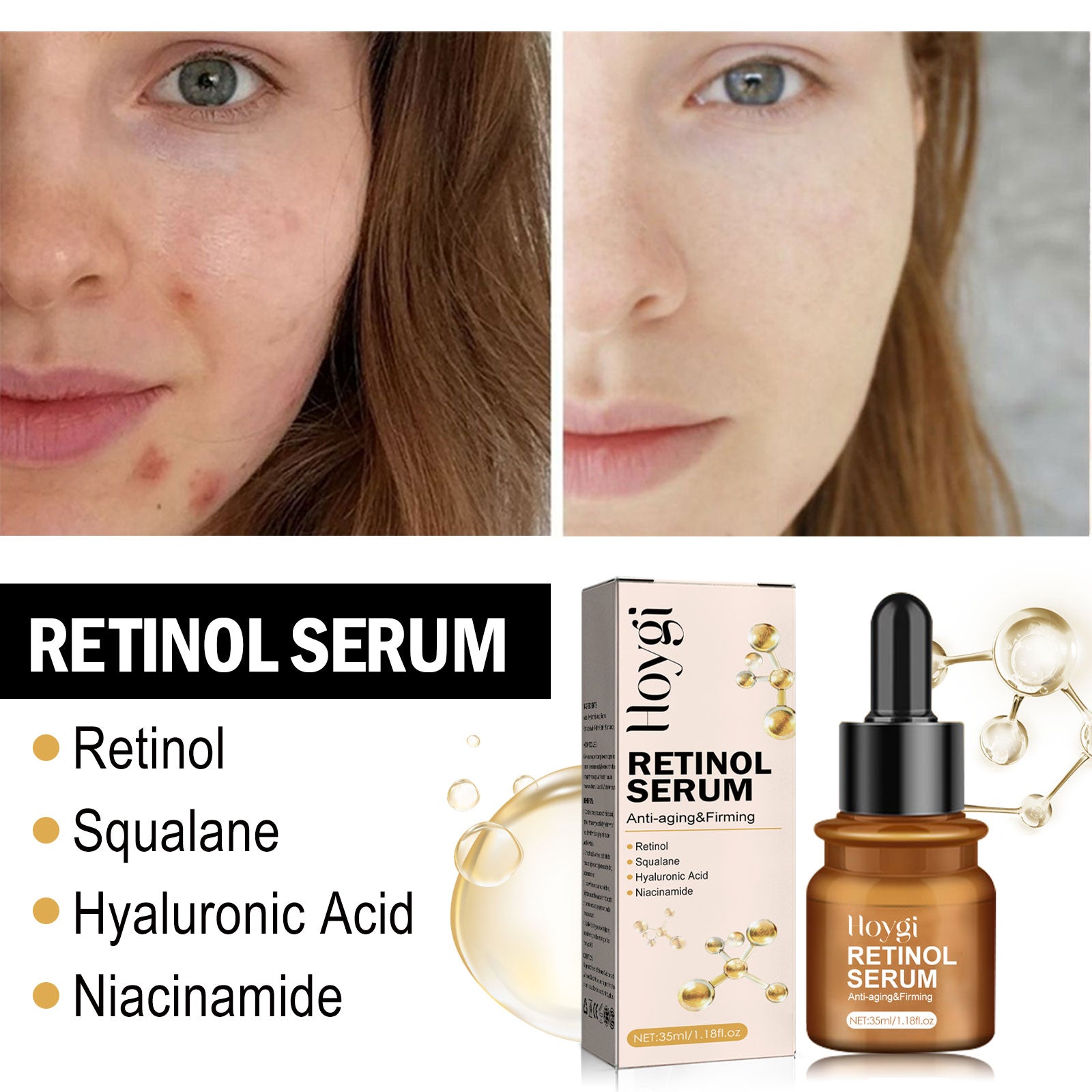 Retinol Anti-Wrinkle Essence Reduces Fine Lines, Firming, Moisturizing And Brightening Anti-Aging Essence