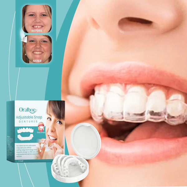 Adjustable Buckle Dentures, Comfortable Adjustable Dentures To Fit The Mouth Chewing Force And Fit The Teeth
