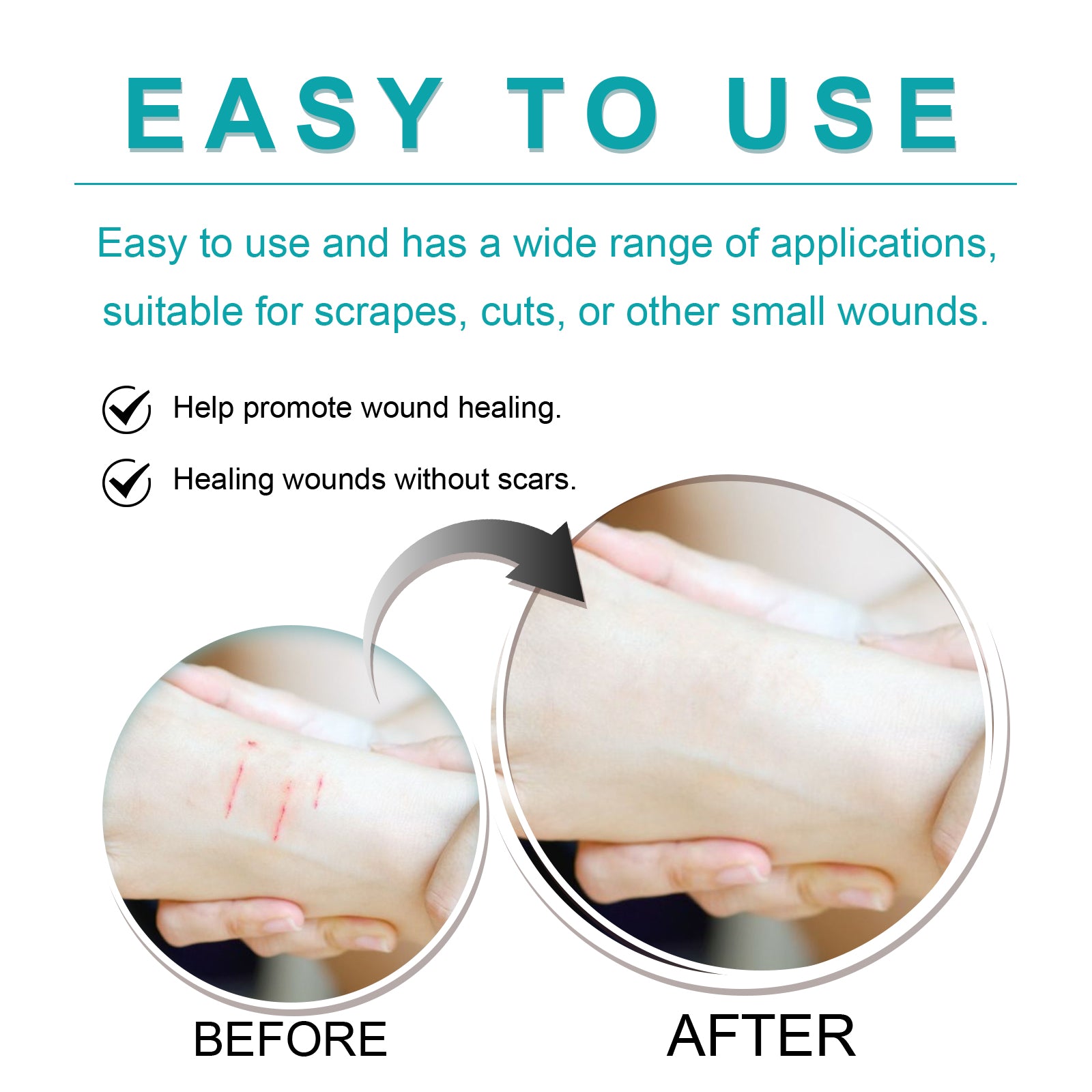 Liquid Bandage Drops Protect Skin Fast Film Formation Breathable Waterproof Skin Repair Drops