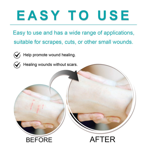 Liquid Bandage Drops Protect Skin Fast Film Formation Breathable Waterproof Skin Repair Drops