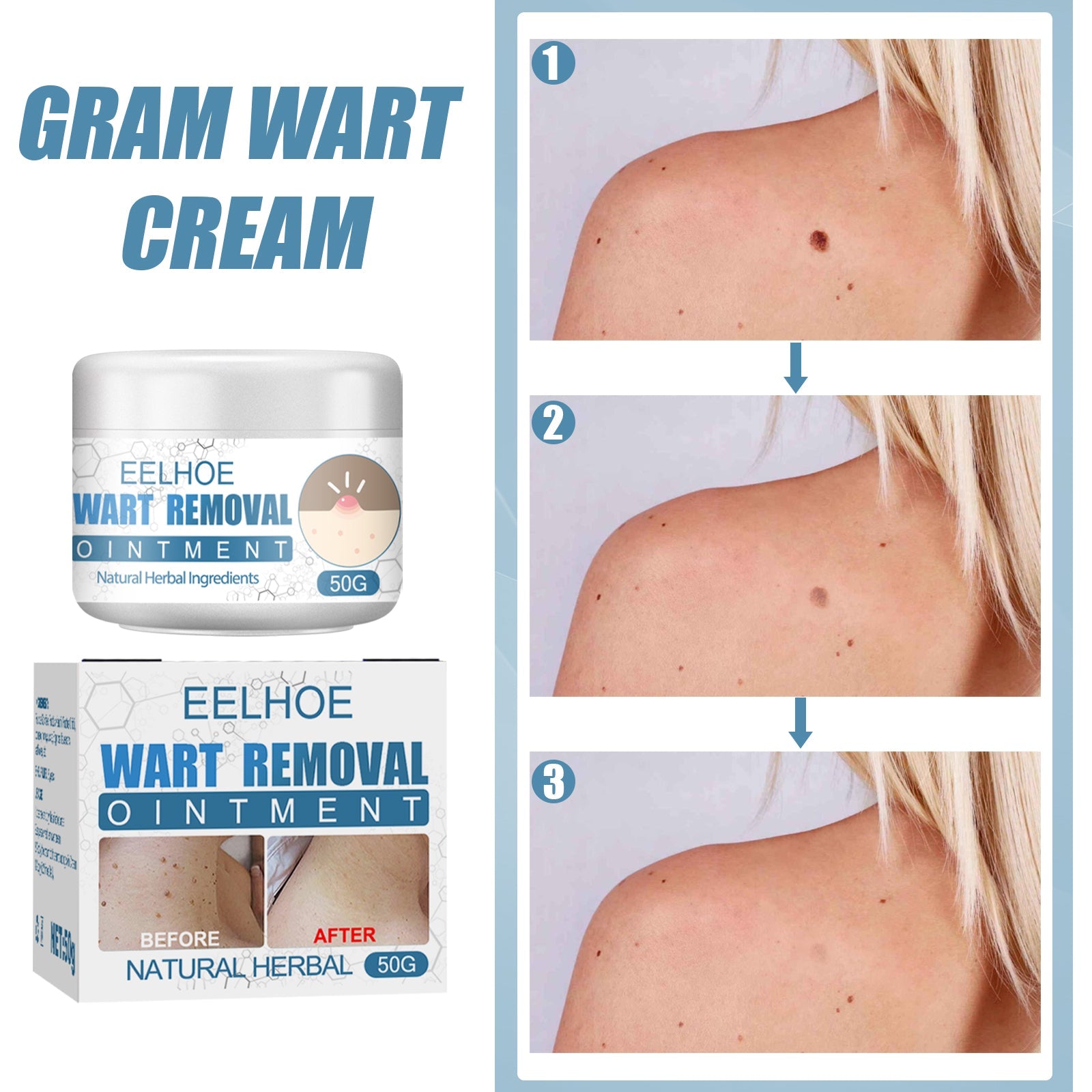 Wart Cream, Skin Clean And Smooth Wart Nevi Facial Care Cream
