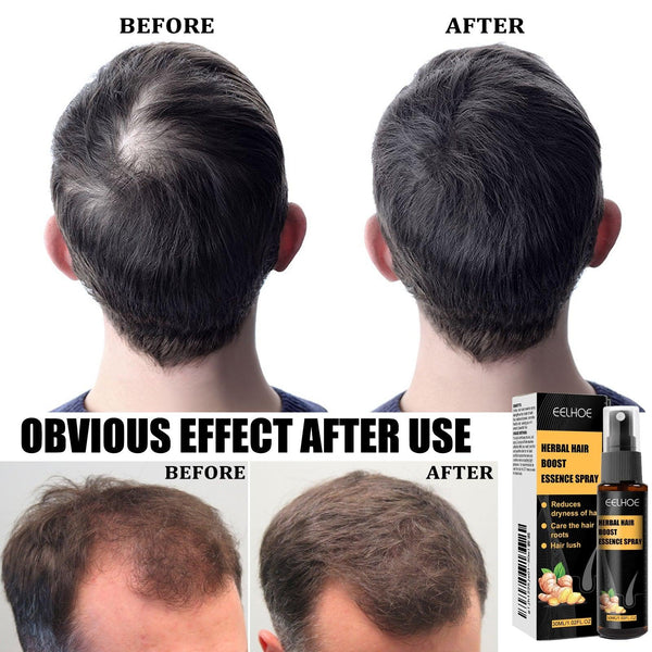 Herbal Hair Essence Spray,Prevent Falling Hair And Scalp Moisturizing And Nourishing Solution
