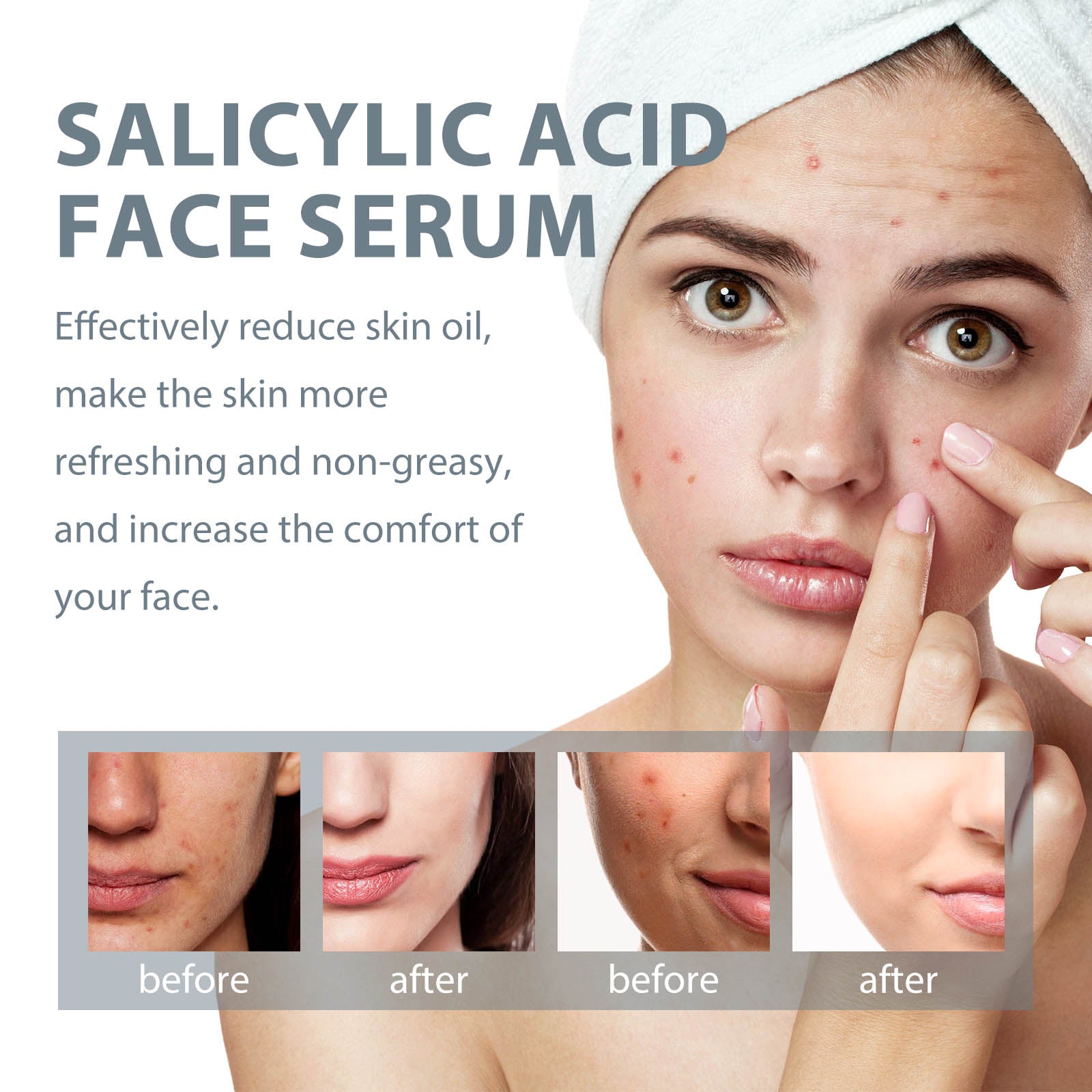 Salicylic Acid Facial Essence, Lighten Acne Mark Repair Hydrating Facial Care Essence