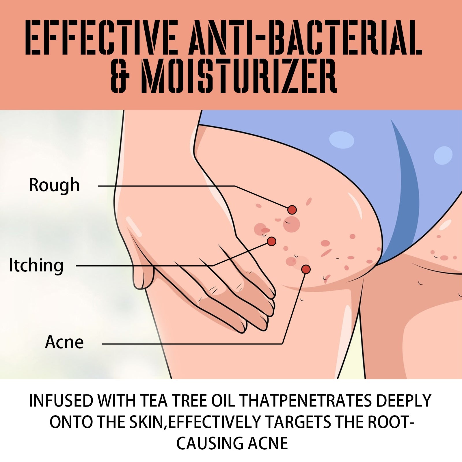 Buttock Care Cream, Repair Rough Buttock Skin Gentle Care Moisturizing And Moisturizing Skin