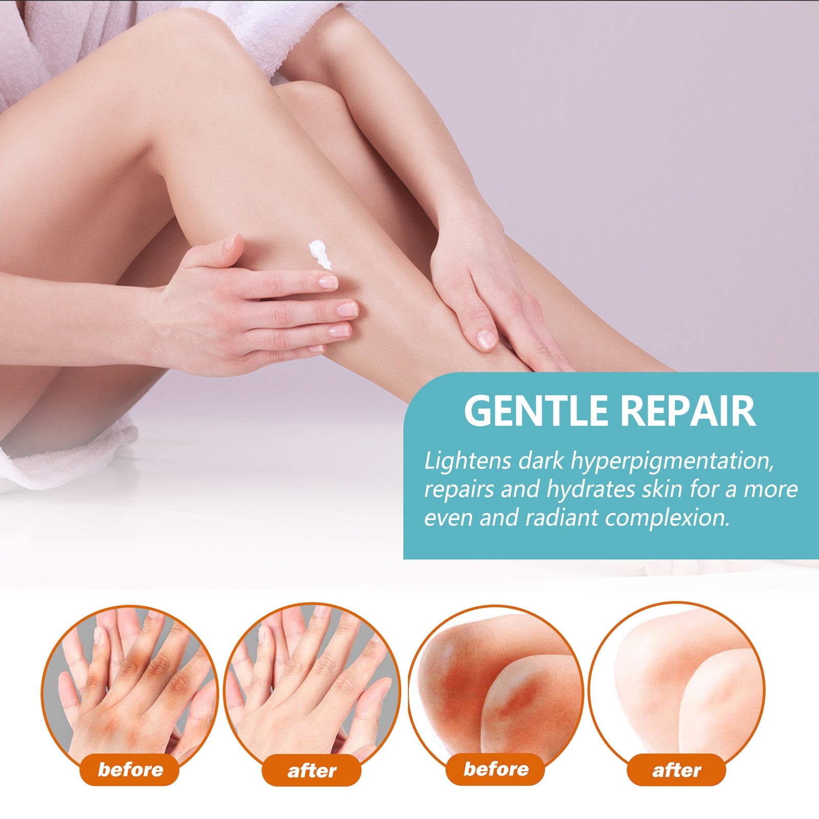 Black Acanthoderm Repair Cream Repair Underarm Arm Knee Joint Black Moisturizing Whitening Body Care Cream