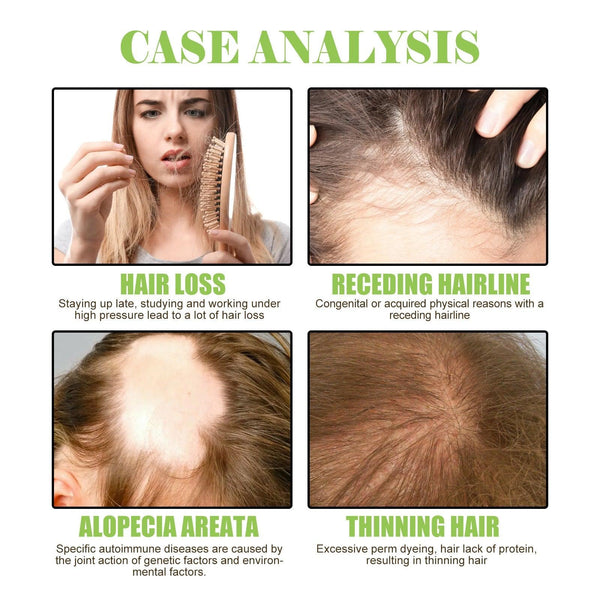 Ginger Care Shampoo Scalp Cleansing, Anti-Break Nourishing Root Strengthening Shampoo