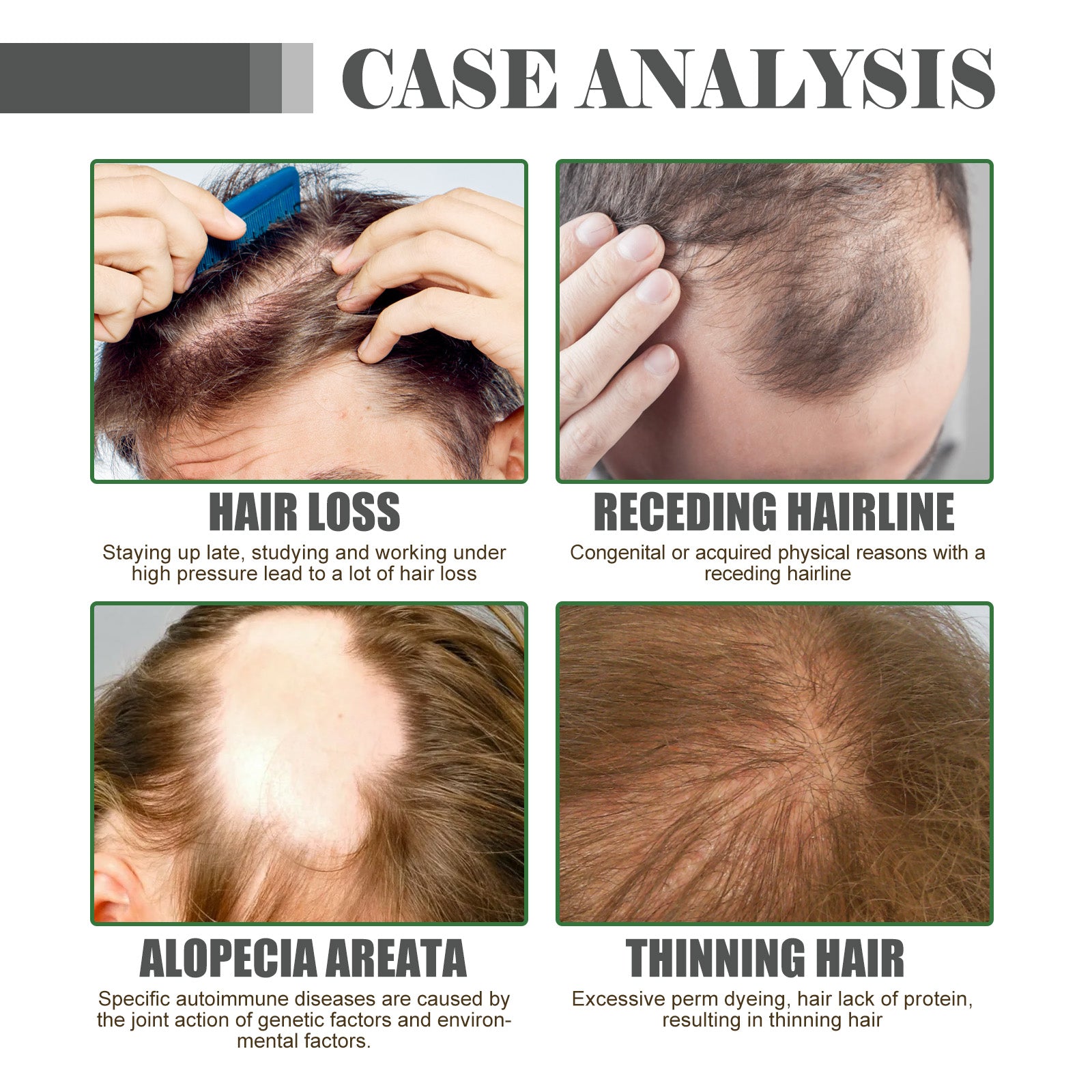 Hair Density Growth Essential Oil, Nourishing Hair Root Repair Perming Dry Damaged Hair Supple Hair Care Essential Oil