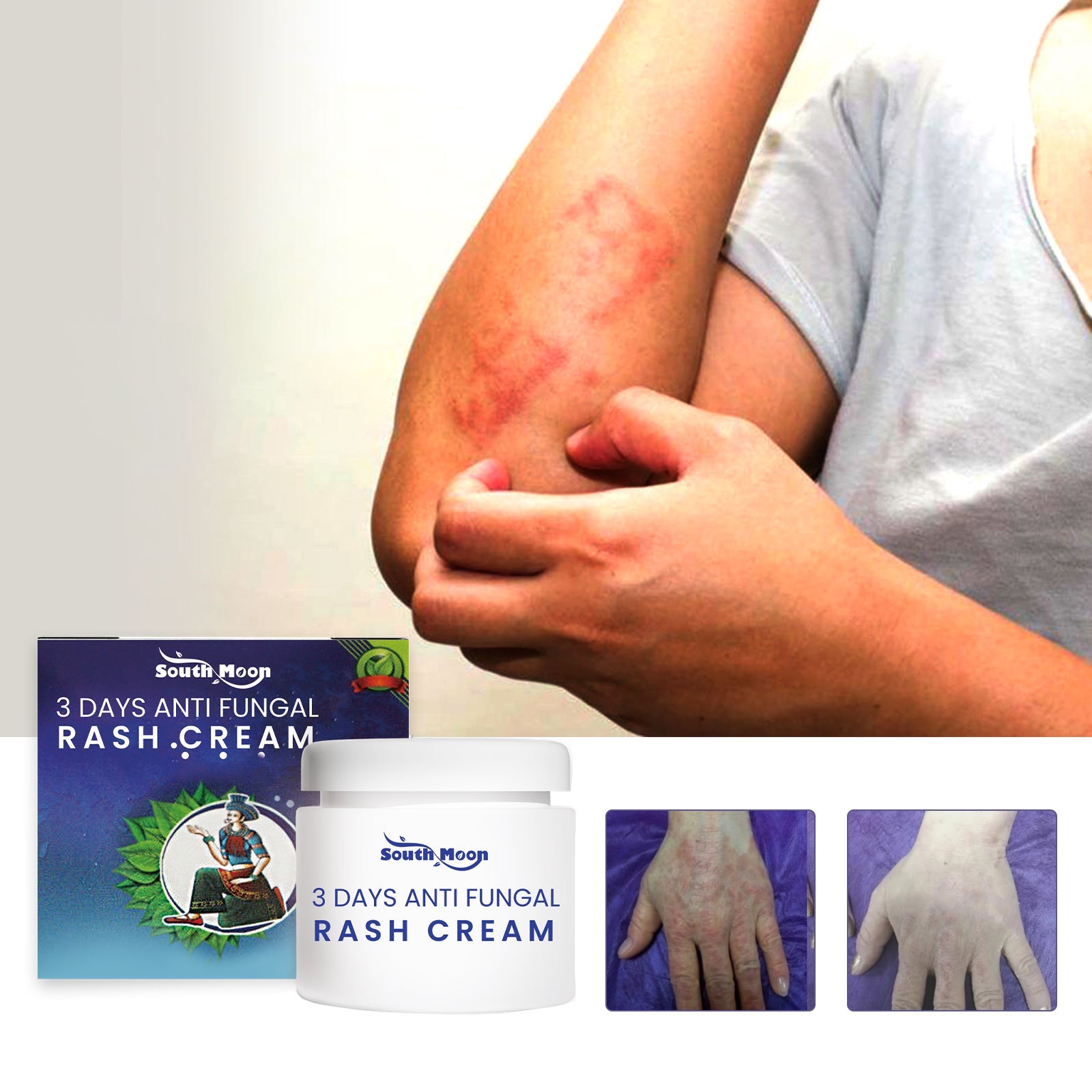 3 Days Aati Fungal Rash Cream, Repair Skin Barrier Soothe Moss Redness And Itchiness Moisturizing Skin Care Cream