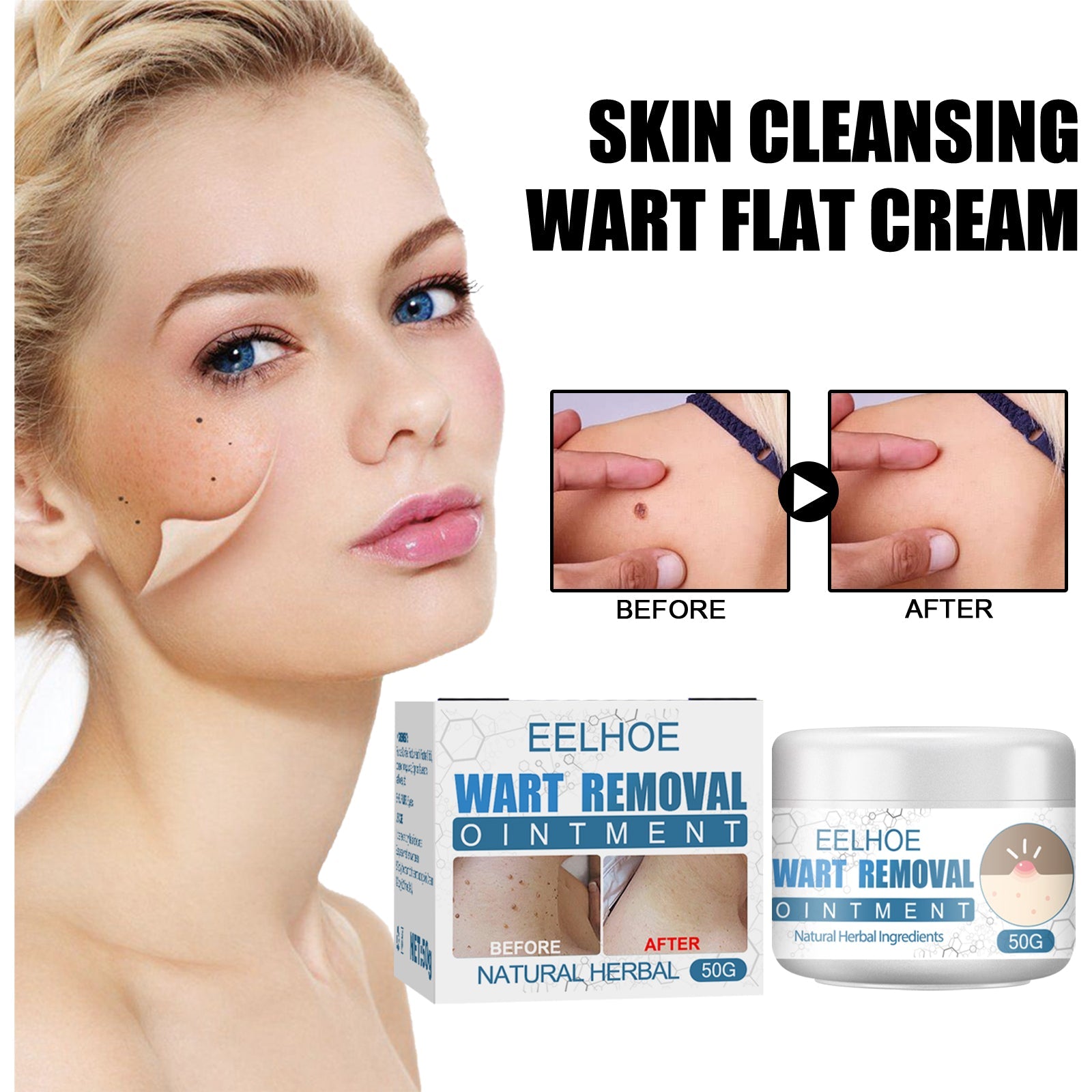 Wart Cream, Skin Clean And Smooth Wart Nevi Facial Care Cream