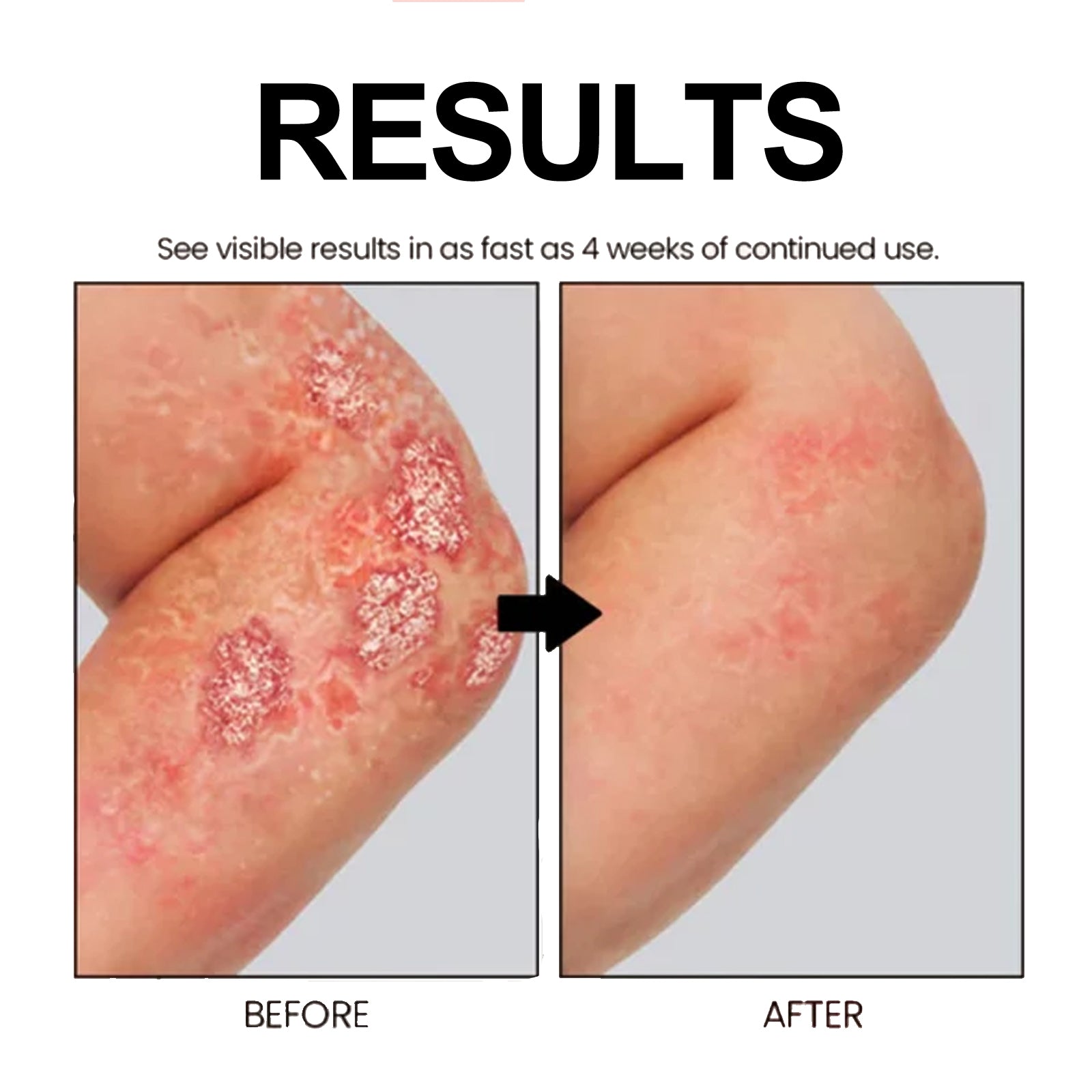 Cowhide Moss Repair Spray Relieves Redness And Itchy Scalp Skin Repair Spray