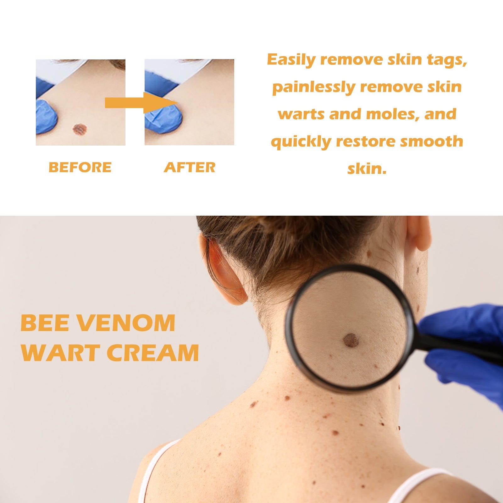 Bee Venom Wart Cream, Repair Smooth Skin Lightening Nevus Spot Nevus Cure Wart Care Cream