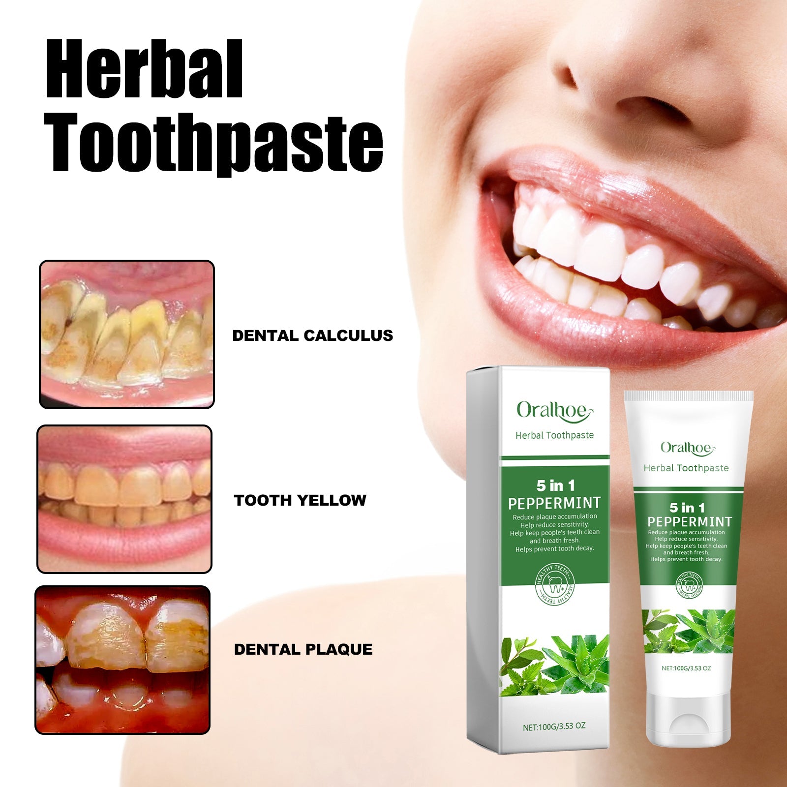 Aloe Whitening Toothpaste Cleans Mouth, Removes Odor, Freshens Breath, Removes Stains, Brighens Teeth And Beautifies Teeth