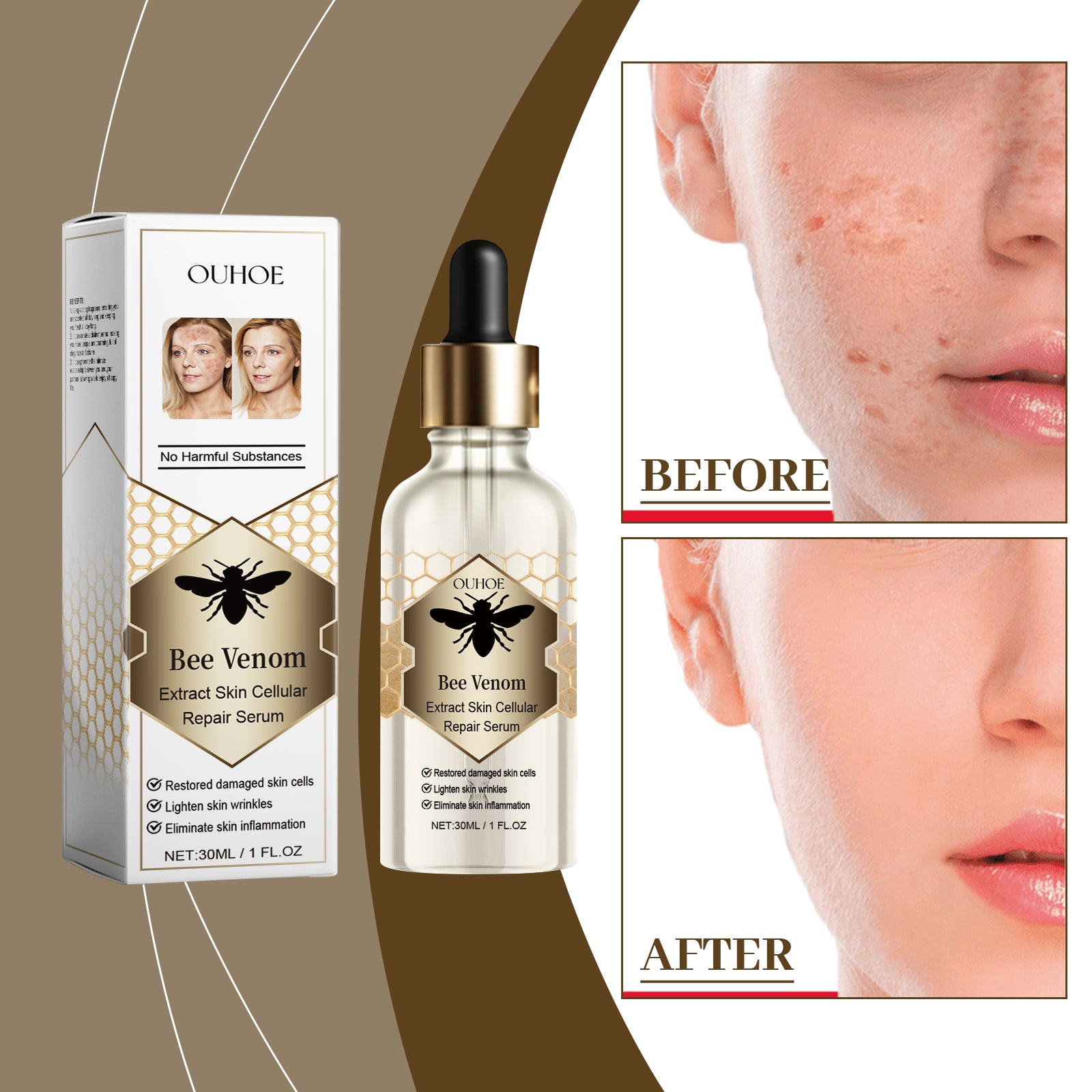 Bee Venom Skin Repair Essence, Body Skin Smoothing And Firming Gentle Moisturizing Massage Treatment Essence