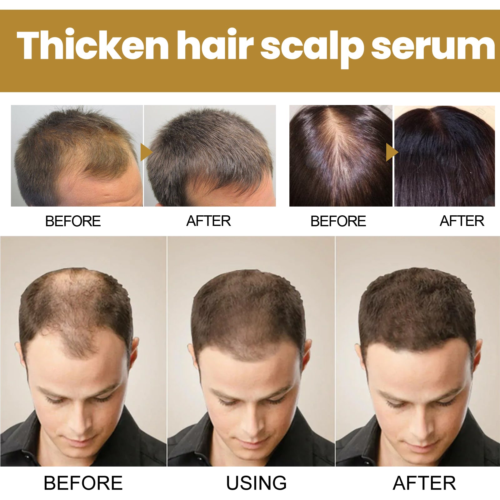 Tight Hair Shampoo Hair Cleansing Massage Scalp To Prevent Loose Tight Hair Roots Strong And Solid Hair Shampoo