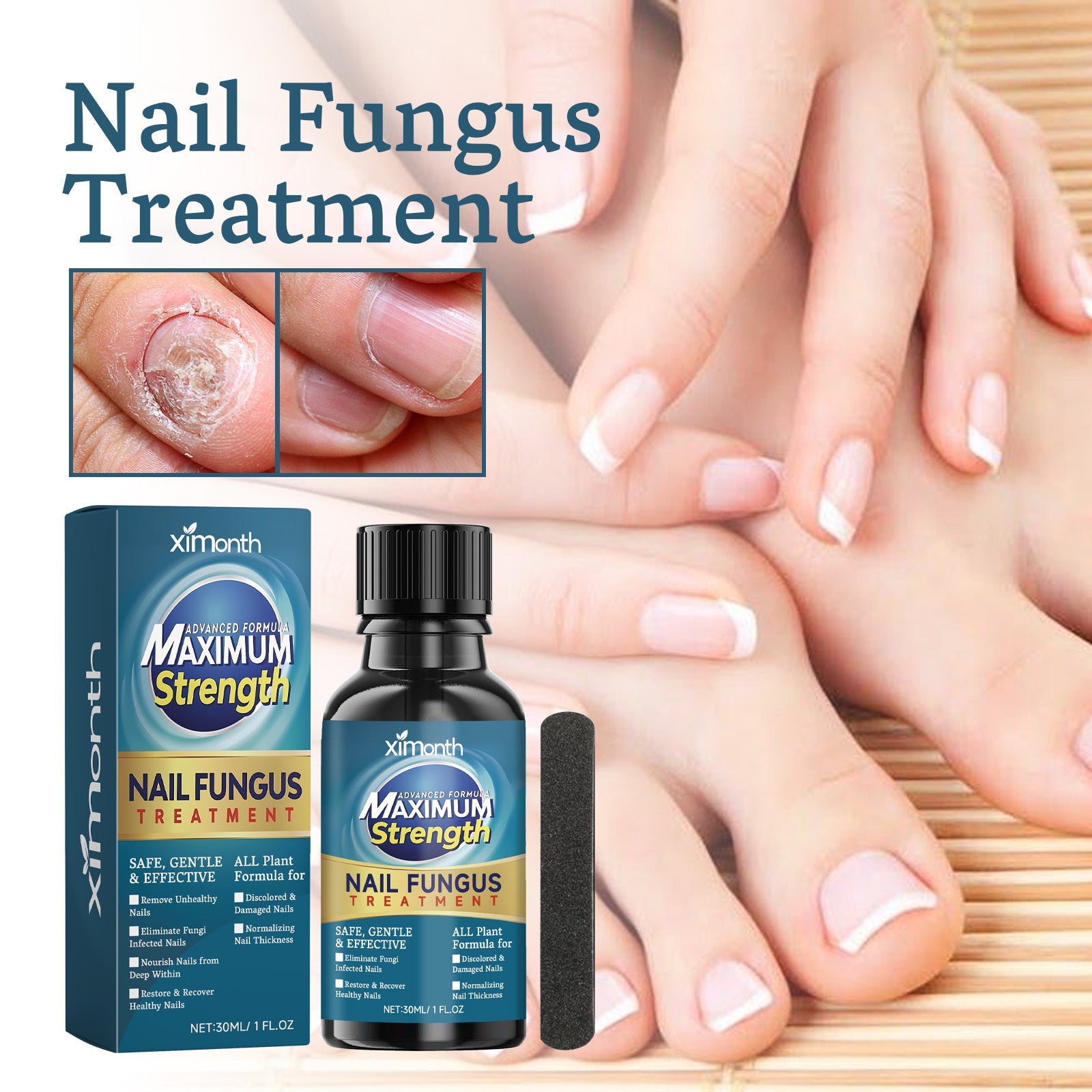 Nail Fungus Treatment, Nail Thickening Of Embedded Light Mail This Soft Armour Brothers Nails Detailer