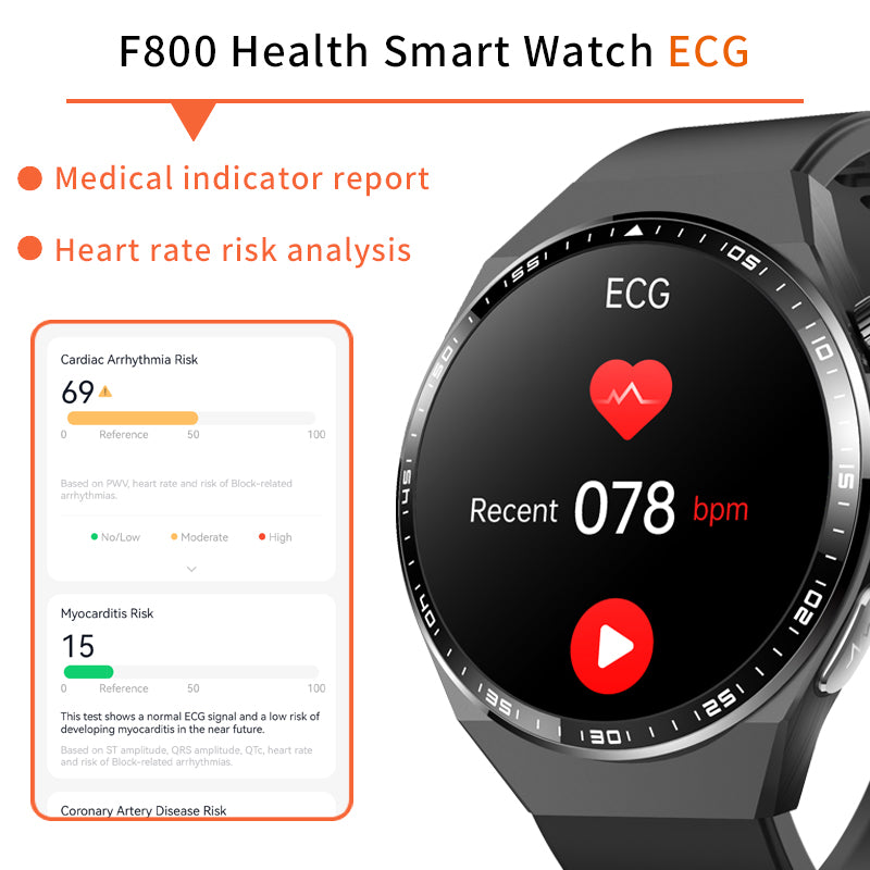 2024 New Accurate Measure ECG+PPG Smart Watch Men Full Touch Screen Sport Fitness Watches Bluetooth For Android ios Smartwatch