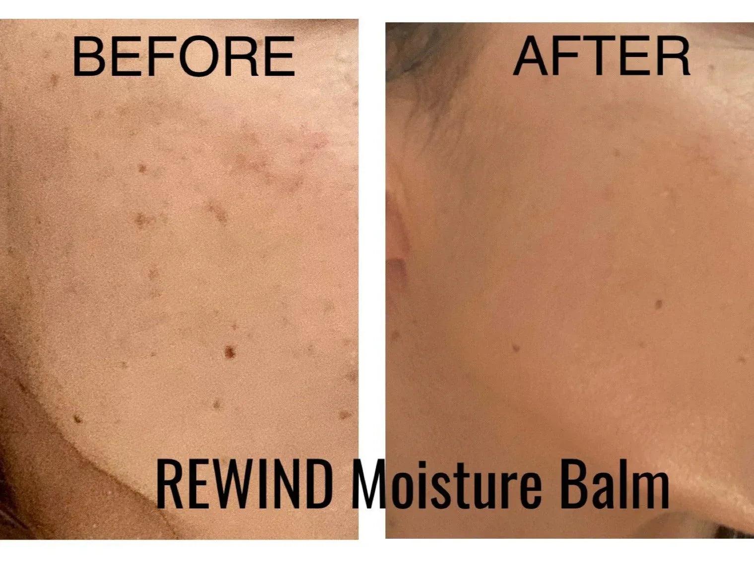 REWIND Hydrating Face Balm with Vitamin C - Gifts for You 'n Me