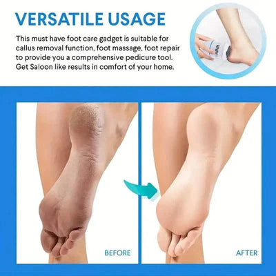 Automatic Vacuum Cleaner and Foot Grinder