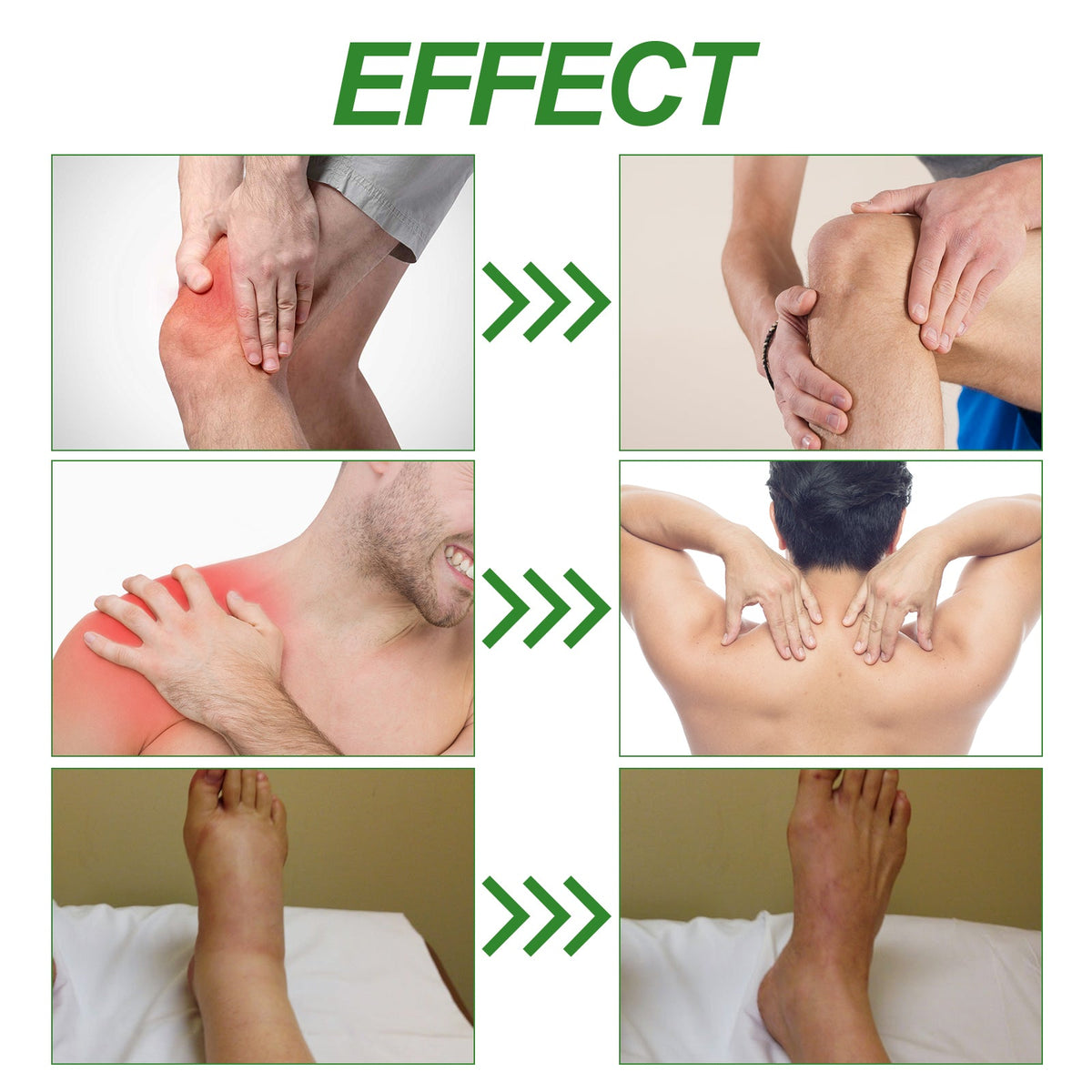 XIMONTHS joint care cream application area for shoulders, neck, legs and knees.